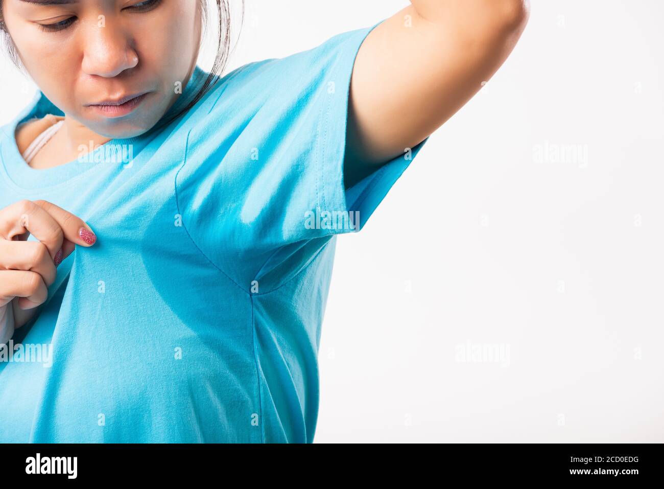 Closeup Young Asian Young Woman Hyperhidrosis Sweating Female Very