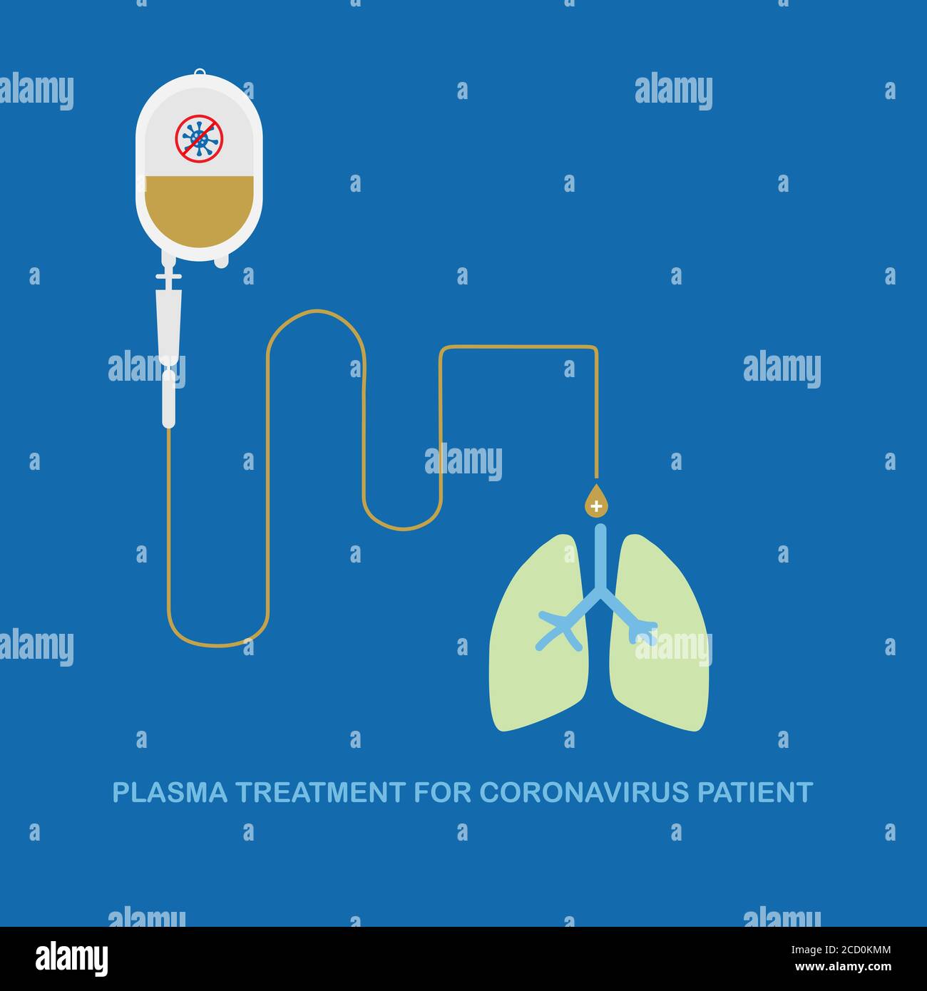 Concept of plasma treatment for coronavirus infection. Plasma treatment helps for the recovery in severely ill patient. Illustration of plasma bag and Stock Vector