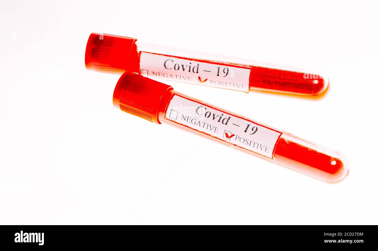 Risk test hires stock photography and images Alamy