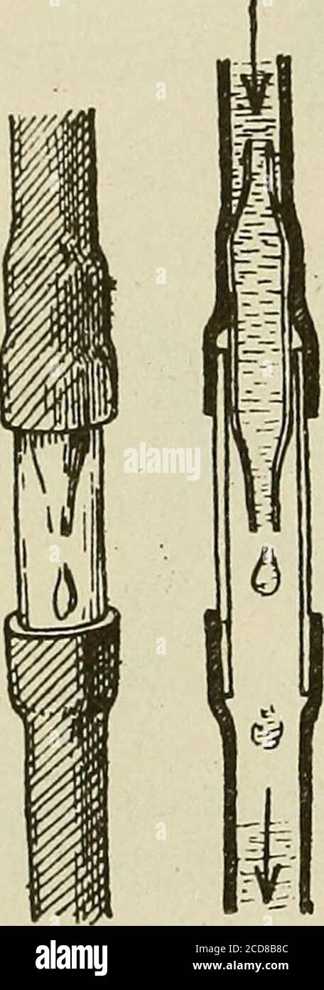 Medical And Surgical Therapy Fig 65 Showing Arrangement In Fowlers Position With Thehelp Of Two Inclined Planes Fixed Together Then Milk Mixed With Vichy Water Finally Lightpurees And Custards Etc