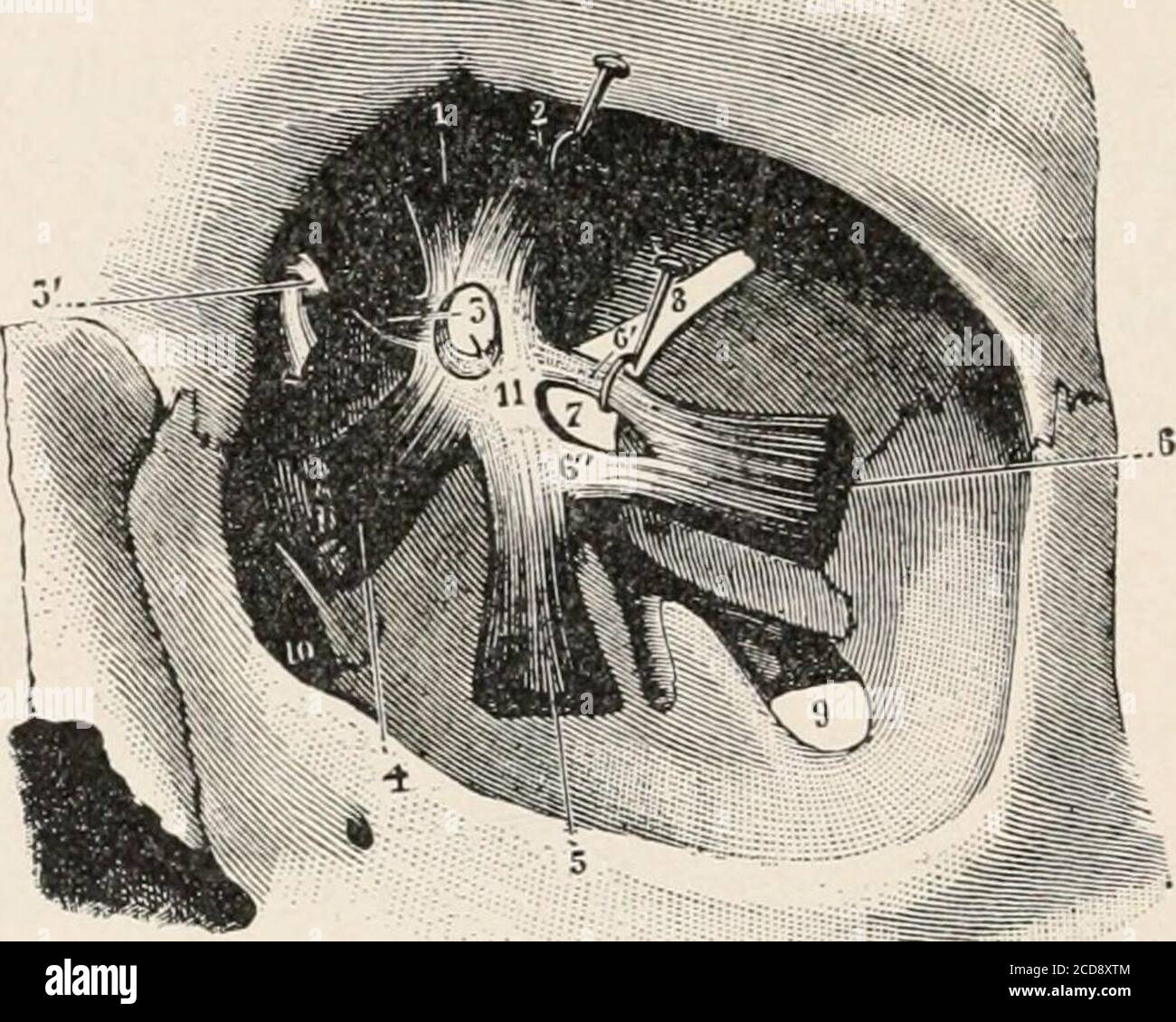 . A treatise on diseases of the eye . )()n-eurotic connective tissue attachments at the apex of the orbit. Internal Rectus.—This is the largest and strongest of the recti nuiscles;it is 41 mm. long, and weighs about 0.75 gram. It passes forward from 1 Ann. dOcul., vol. ci, p. 123. Miel and Benoit, Arch, dopht., vol. x.x. 4, p 101. 3G ANATOMY the apex of the orbit, nearly parallel to the inner wall of the orbit, to theequator of the globe; it is inserted into the sclera 6.5 to 7 mm. from themargin of the cornea. The insertion is in a slightly curved line, convexitytoward the cornea. The width o Stock Photo