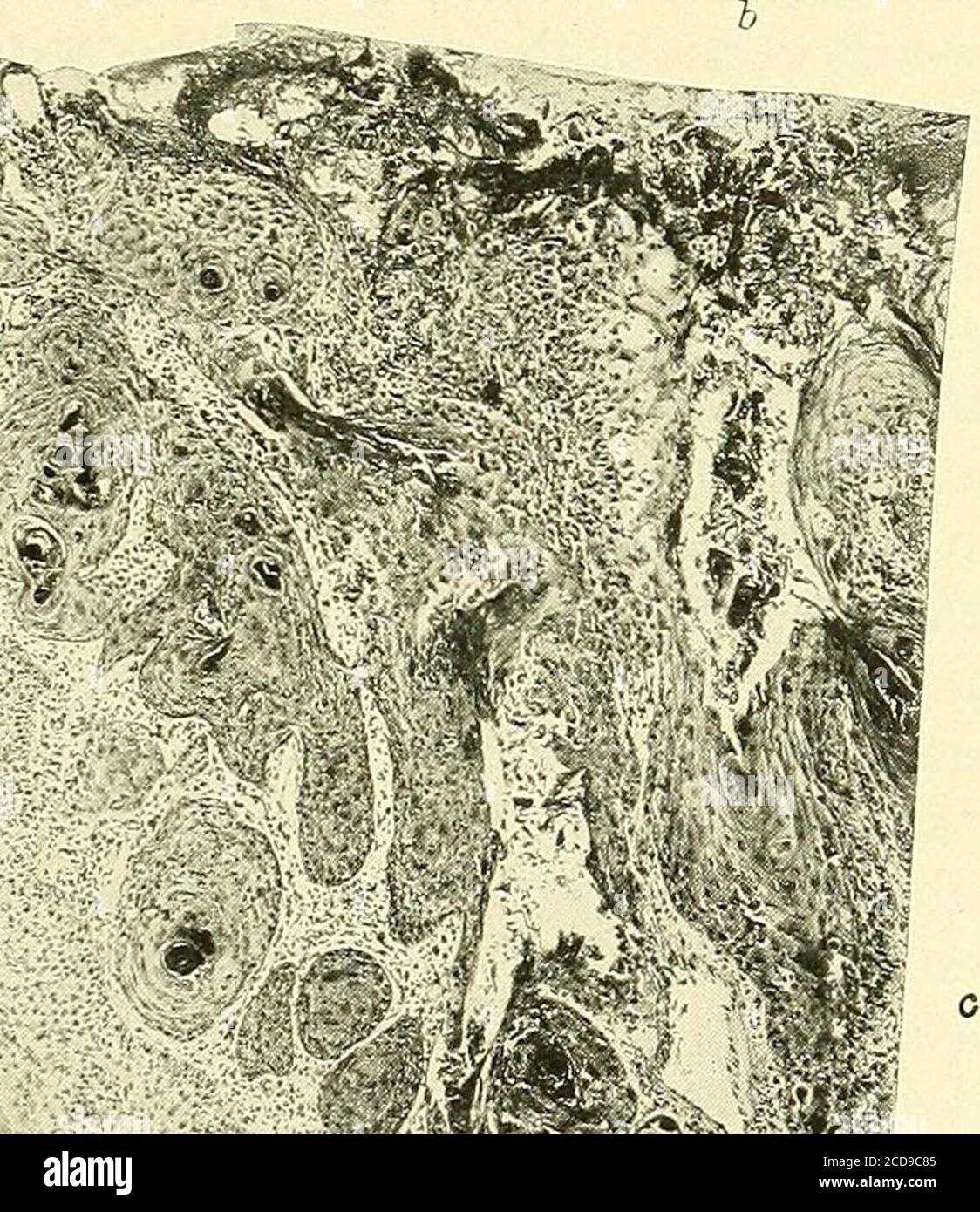 Macerated tissue hires stock photography and images Alamy