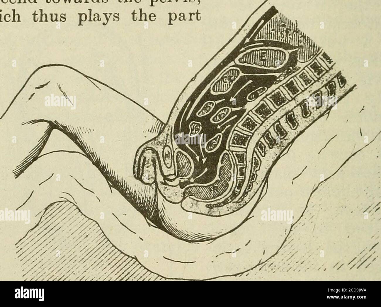 Medical and surgical therapy . (blood, intestinal con-tents, etc.).  jectiles. If the passage of communication with theexterior in the  sacro-coccygeal region is widely openedwe can observe the progressive  cicatrisation of therectal