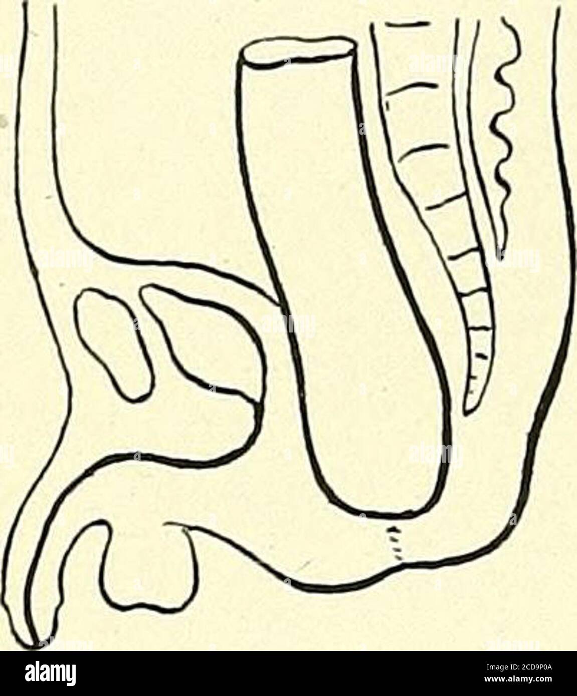 . Surgery, its principles and practice . Bivalve Rectal Speculum. 118 SURGERY OF THE RECTUM AND