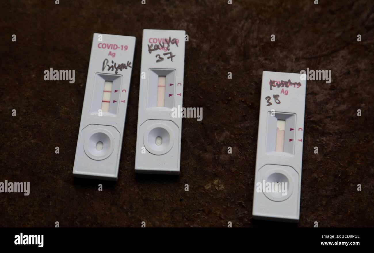 New Delhi, India. 27th Aug, 2020. A view of the standard Q Covid-19 Antigen Test strip as devices showing Positive test results after the Coronavirus, covid-19 test at a testing site.In India 75,760 new cases were registered in a single day and more than 3,310,234 confirmed cases of Covid-19 and 60,472 deaths. Credit: SOPA Images Limited/Alamy Live News Stock Photo