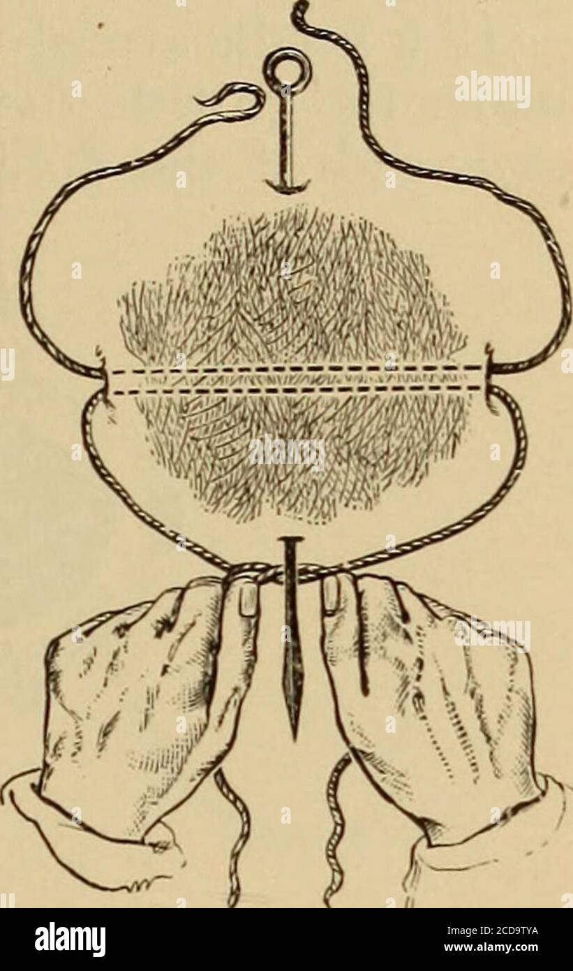 . Minor and operative surgery, including bandaging . Method of applying