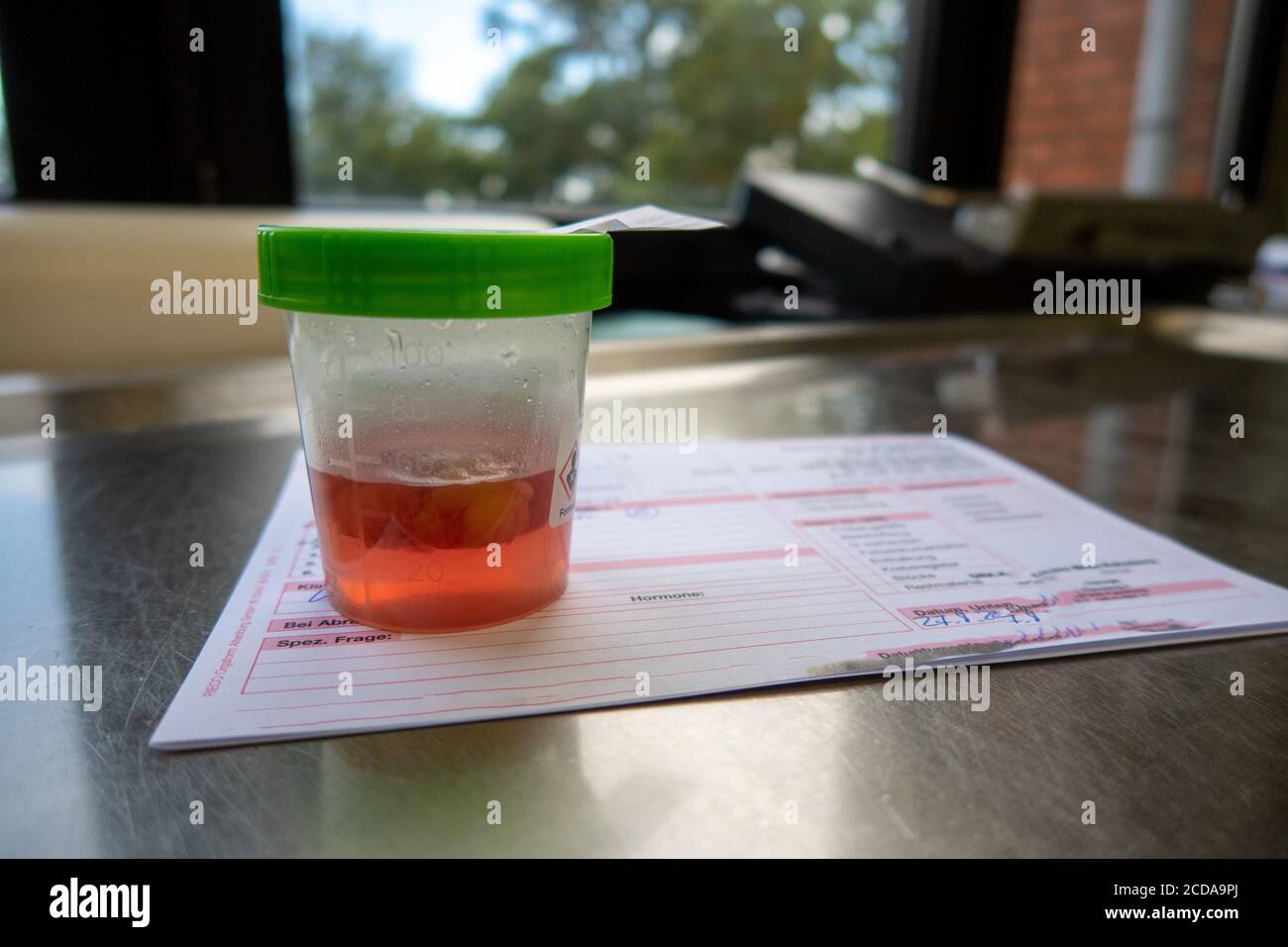 a histological tissue preparation after an operation is on a lab time Stock Photo