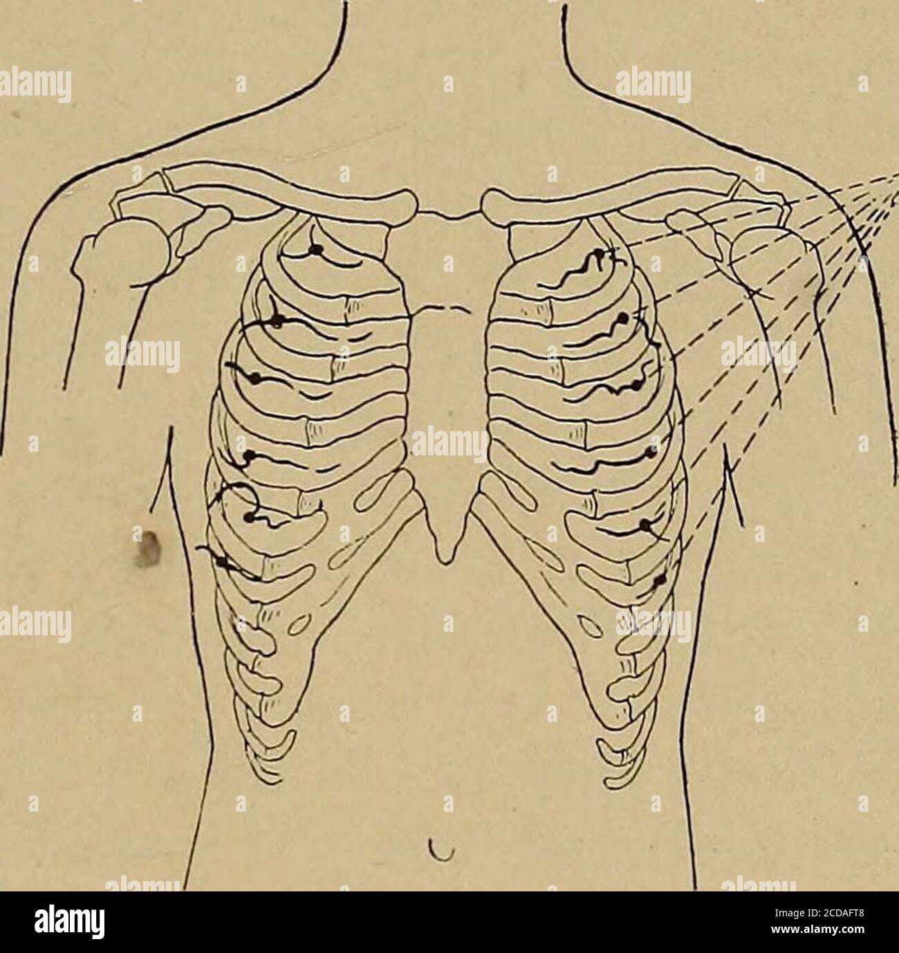 Neuralgia intercostal hires stock photography and images Alamy