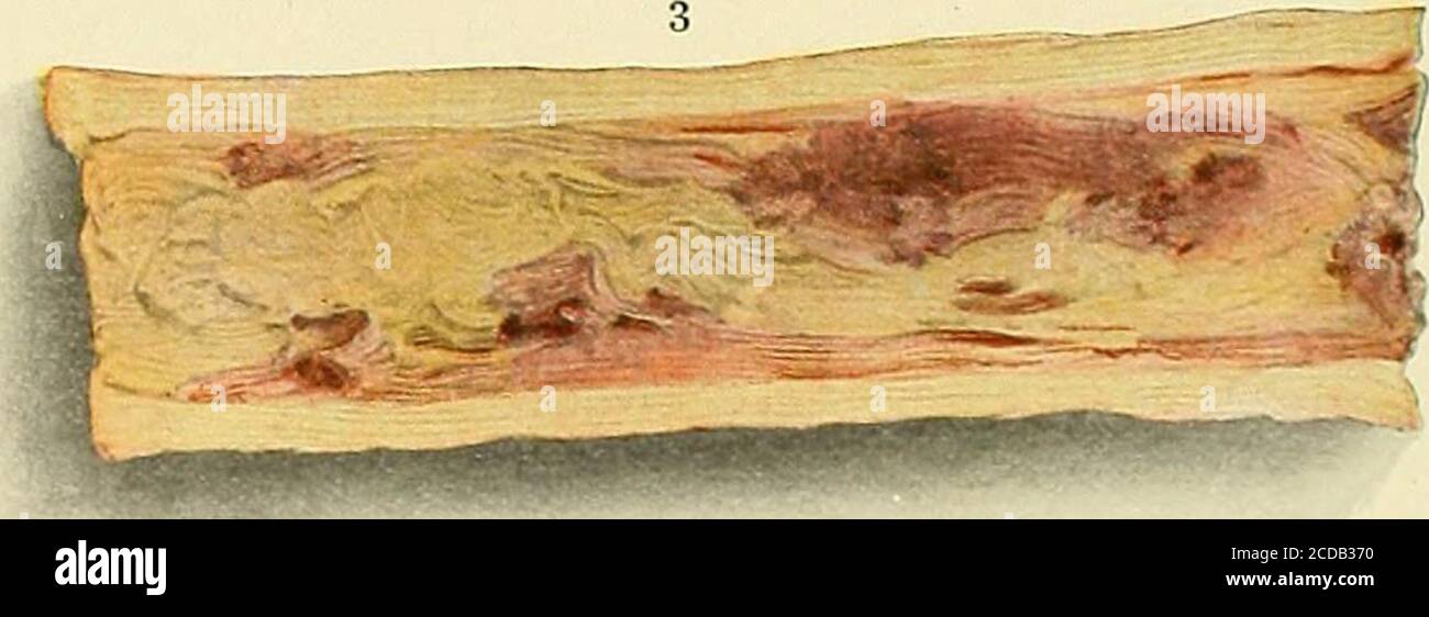 . The practice of medicine; a text-book for practitioners and students, with special reference to diagnosis and treatment . ^mmmmmmmmmm. Stock Photo