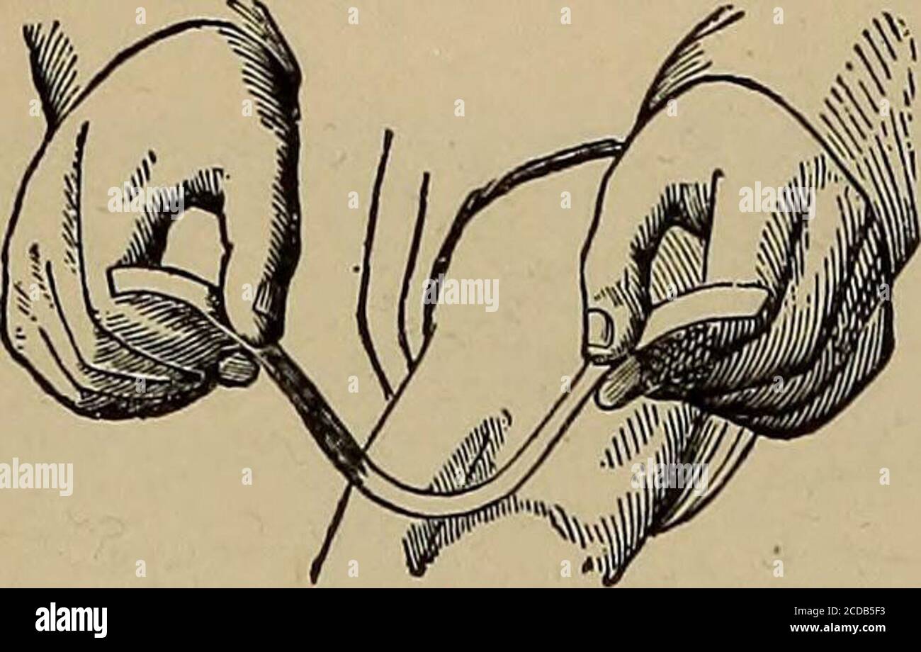 Hair stuck together hires stock photography and images Alamy