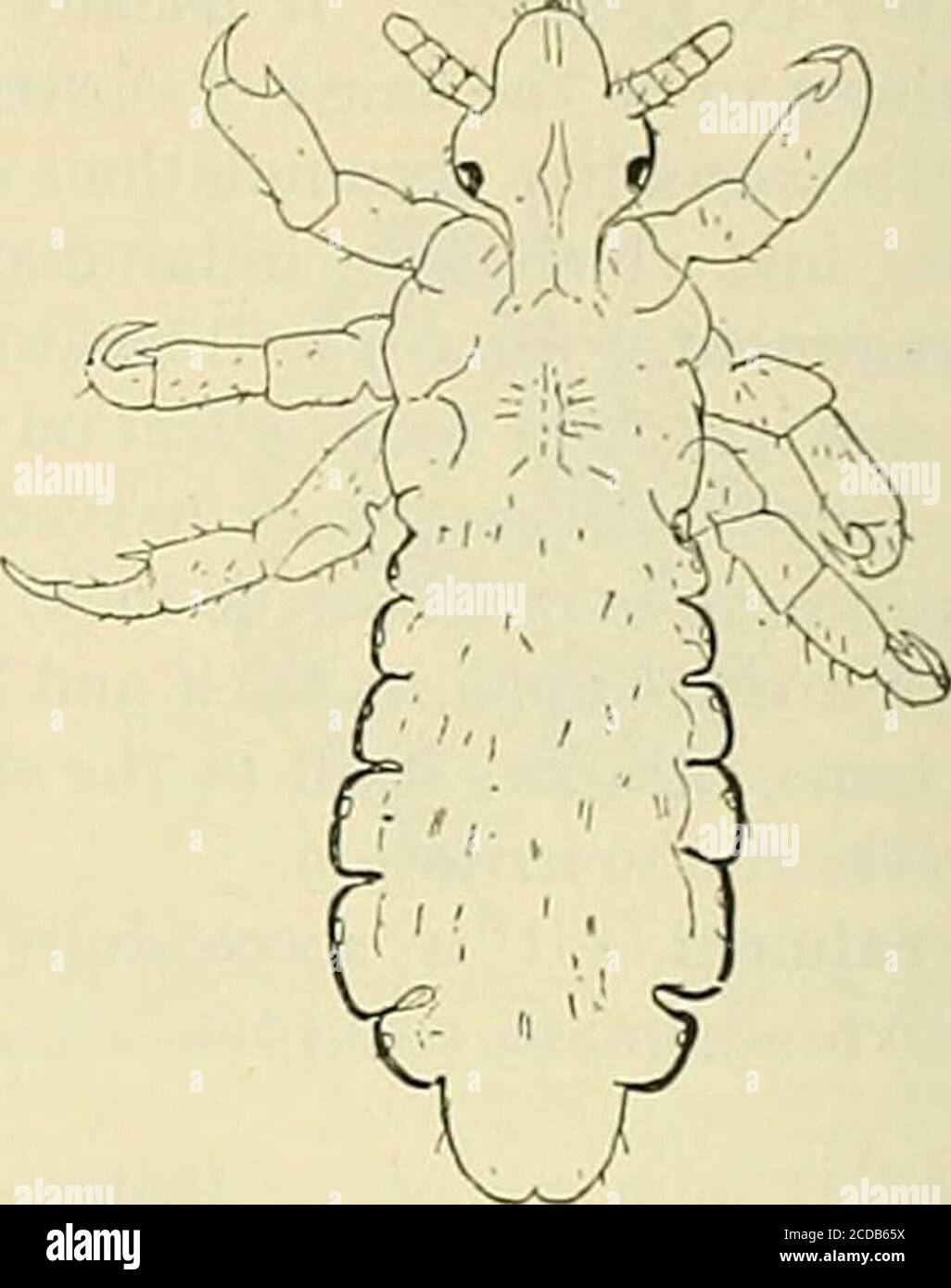 . The practice of medicine; a text-book for practitioners and students, with special reference to diagnosis and treatment . Fig. 82.—Ovum of head-louse glued to Fig. 83.—Pediaitus capitis: XiS. (Braun.)hair: X70. (Branti.) axilla, and eyebrows. The pediculus pubis does not wander so much as thepediculus capitis or vestimenti, but adheres more closely to the skin and there-fore removal is often with difficulty. These lice give rise to annoying itching about the pubes. Treatment of Pediculosis.—For the head lice: The hair should be cut Stock Photo