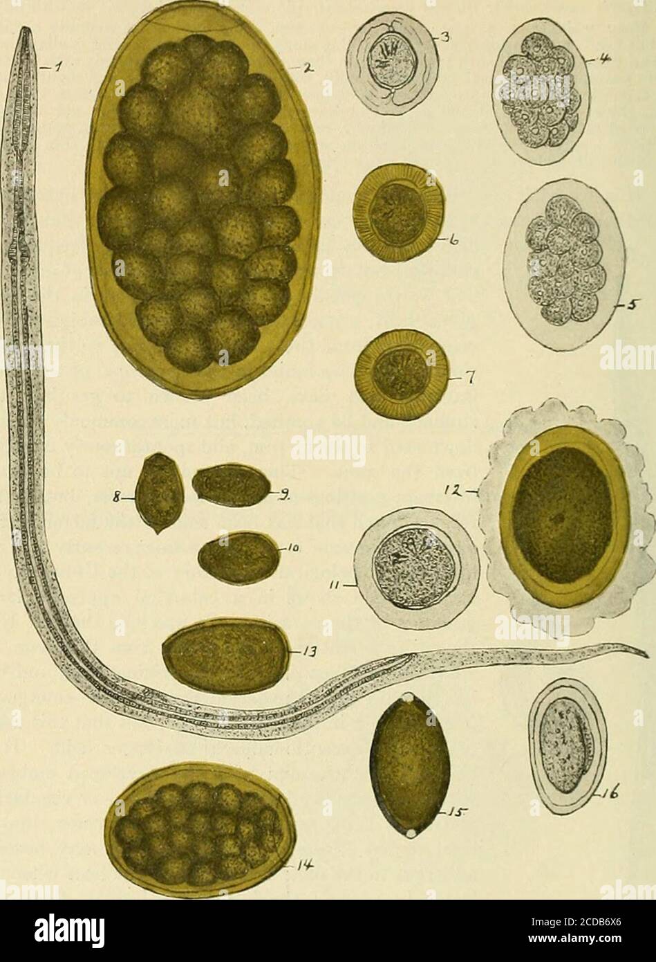 The practice of medicine; a text-book for practitioners and students, with  special reference to diagnosis and treatment . Fig. 80.—Ovum ofoxyuris  vermicularis. 236 INF EC no US DISEA SES. 1. Larval