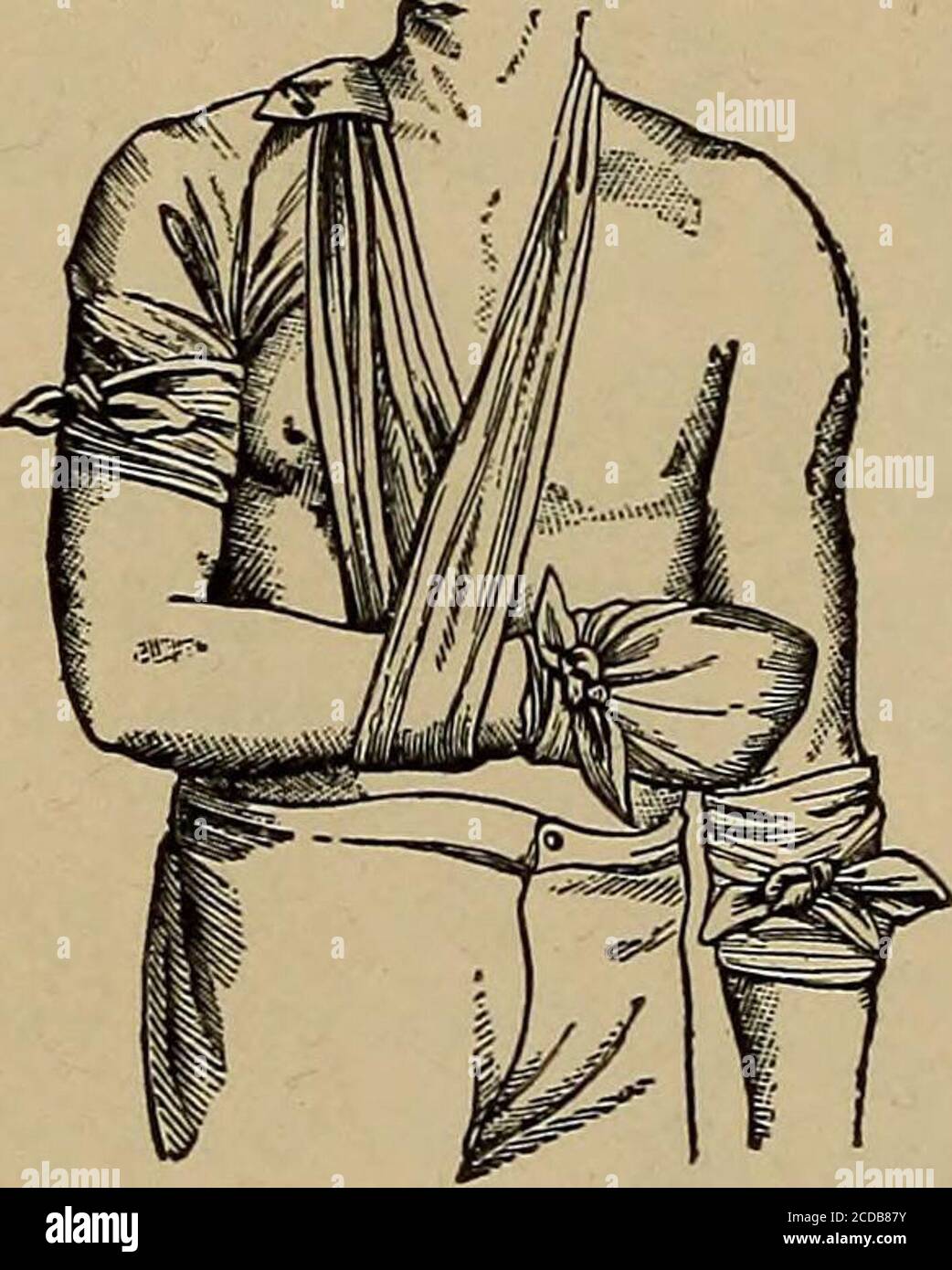 First aid in illness and injury; . nd well up on theneck; (2) carry the two  ends aboutthe arm, (3) cross them on its innerface, and tie them in a reef