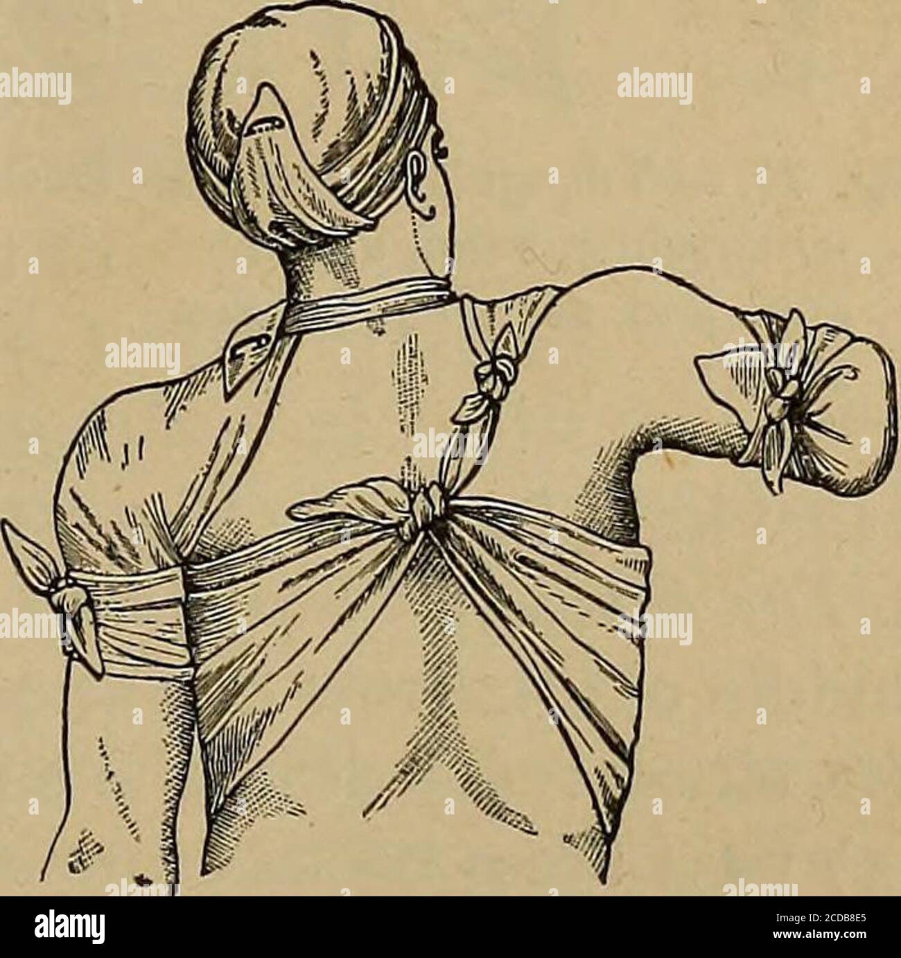  First Aid In Illness And Injury Fig 72 Triangular Bandage Forthe 