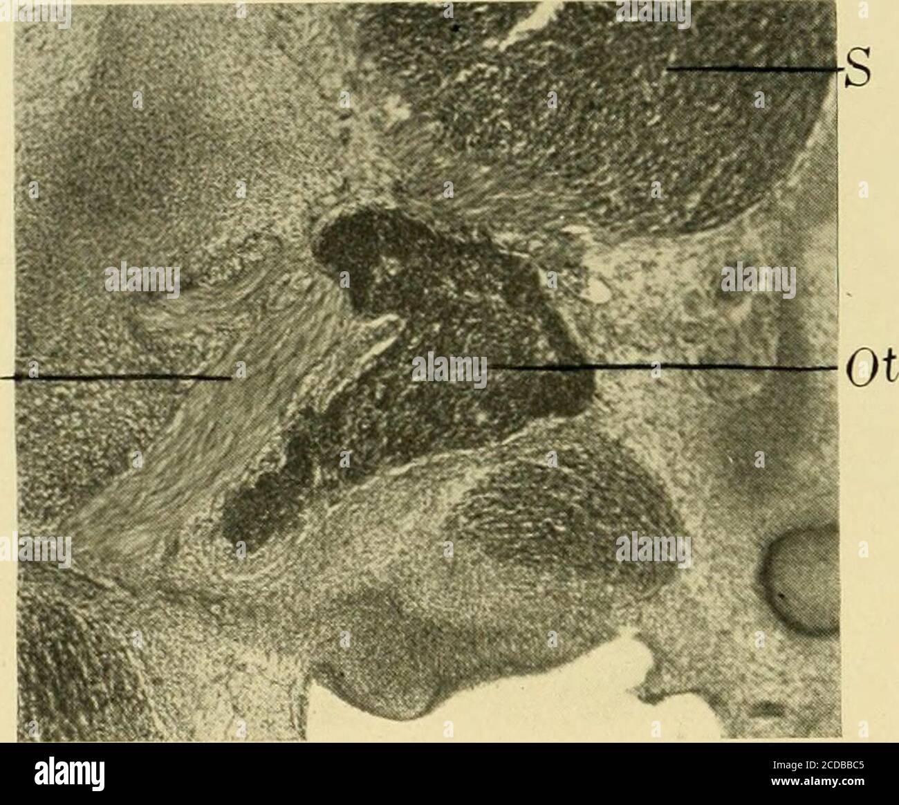 . Journal of comparative neurology . Fig. 11 Parasagittal section near  median surface of mandibular nerve, embryoof pig 17 mm. in length. E,  eustachian tube; Jug, jugular vein; Man, mandibu-lar nerve; Ot, otic  ganglion; *S, semilunar ganglion. Fig. 12