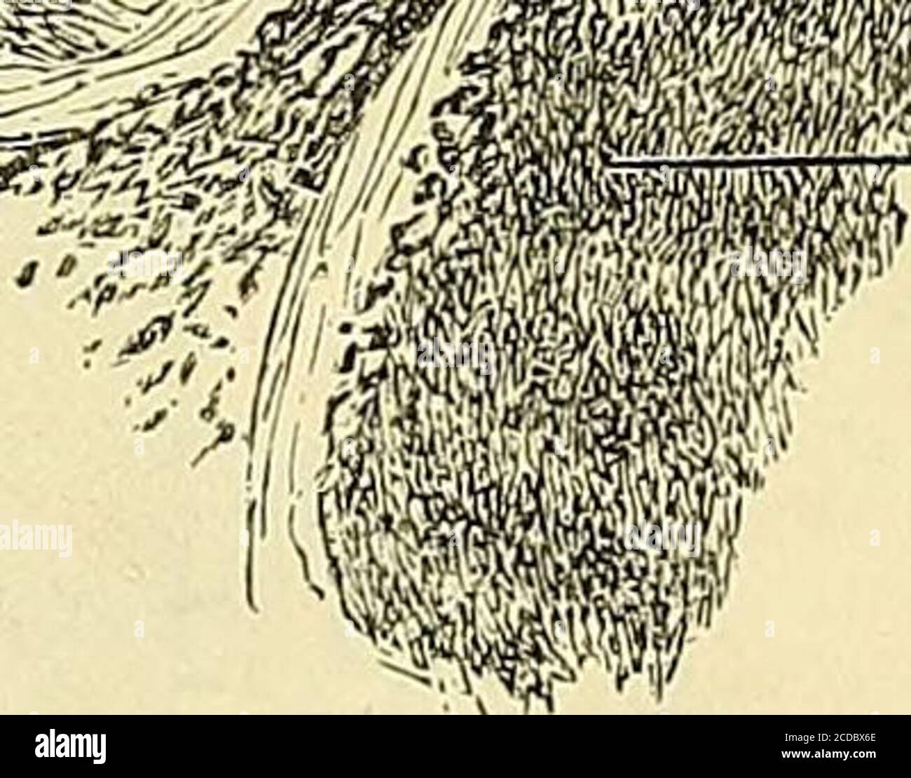 Page 2 Tumeur High Resolution Stock Photography And Images Alamy