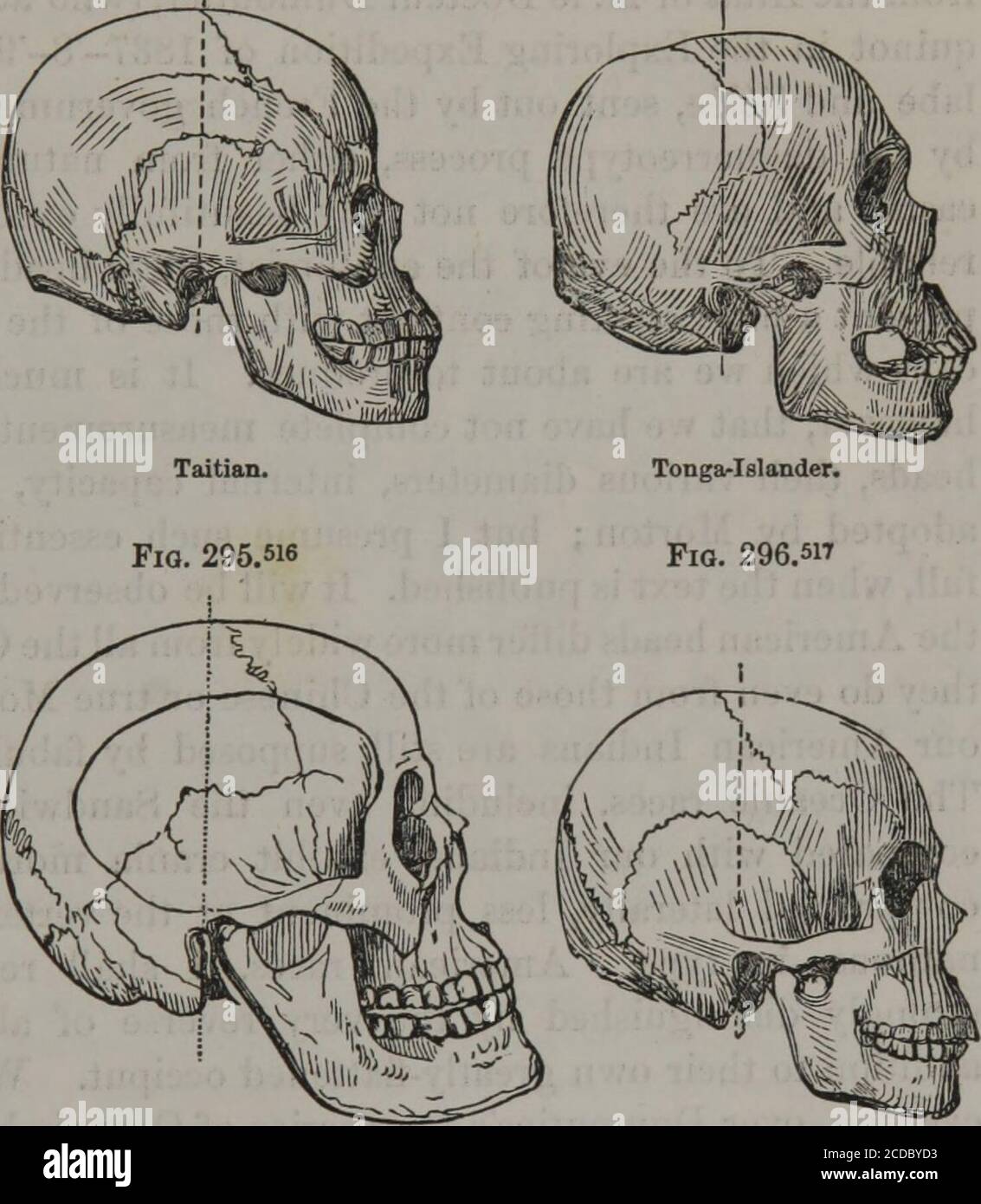 Types Of Mankind Or Ethnological Researches Based Upon The Ancient Monuments Paintings Sculptures And Crania Of Races And Upon Their Natural Geographical Philological And Biblical History Guanche Fig 293 5u Types Of Mankind Or Ethnological Researches Based Upon The Ancient Monuments Paintings Sculptures And Crania Of Races And Upon Their Natural Geographical Philological And Biblical History Guanche Fig 293 5u
