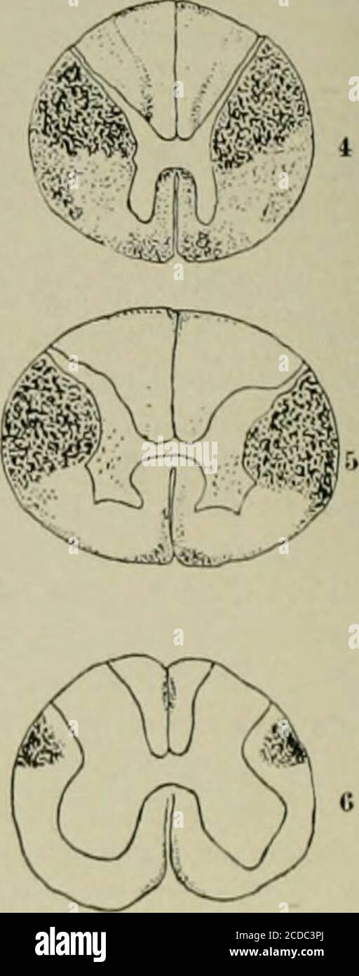 . An atlas of the differential diagnosis of the diseases of the nervous ...
