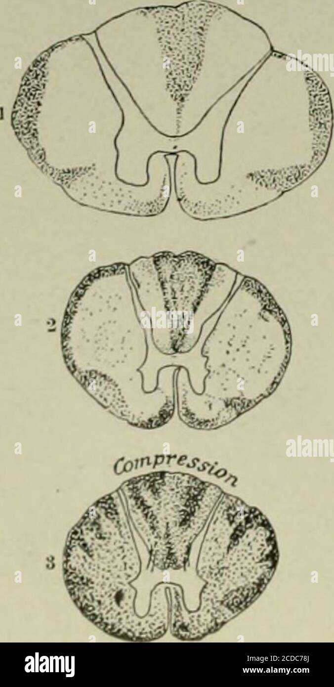 . An atlas of the differential diagnosis of the diseases of the nervous ...