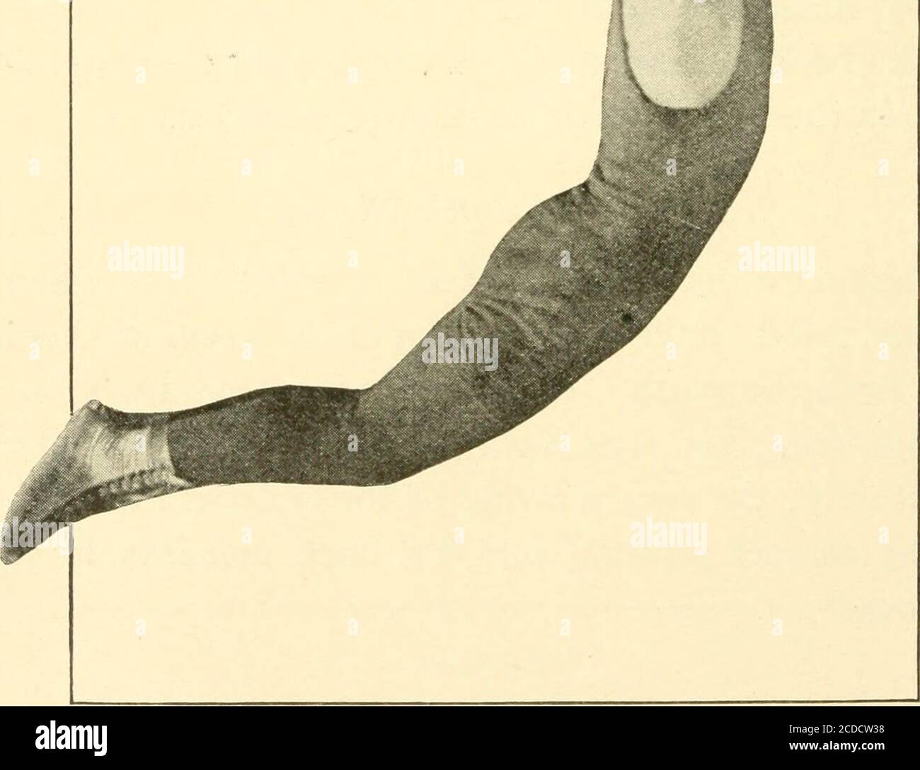 Exercises On The Side Horse M W O I Spaldings Athletic Library 69 Figure 10 Front Flyaway At End Of Back Swing In Attempting The Front Flyaway One Should Wearthe Hmgers