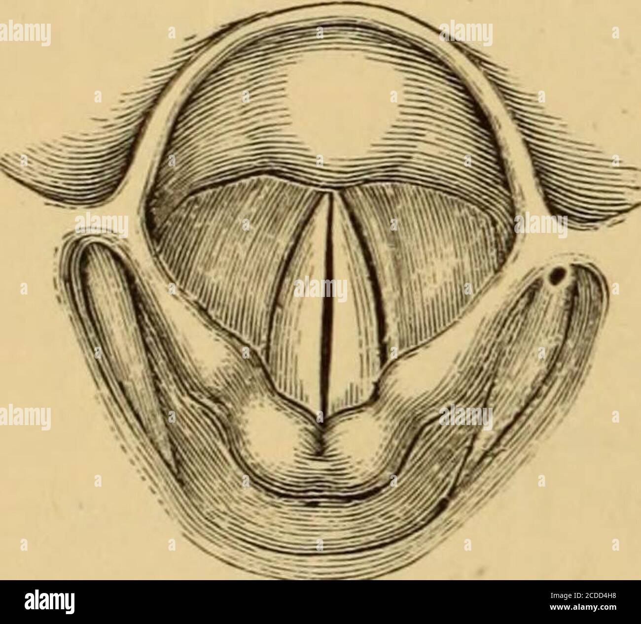 . Diseases of the throat and nasal passages; a guide to the diagnosis and treatment of affections of the pharynx, sophagus, trachea, larynx, and nares . constitutes thevibrating medium of the voice. The vocal cord, at least its lower surface, is an extension inward of the vocalmembrane, or the middle crico-thyroid ligament. Each cord consists of a com-pact band of parallel fibres of the thyro-arytenoid muscle, and of elastic andfibrous tissue, arranged in prismatic form, the base presenting outward, so thata vertical section shows the upper surface horizontal, and the lower surfacetaking an ob Stock Photo