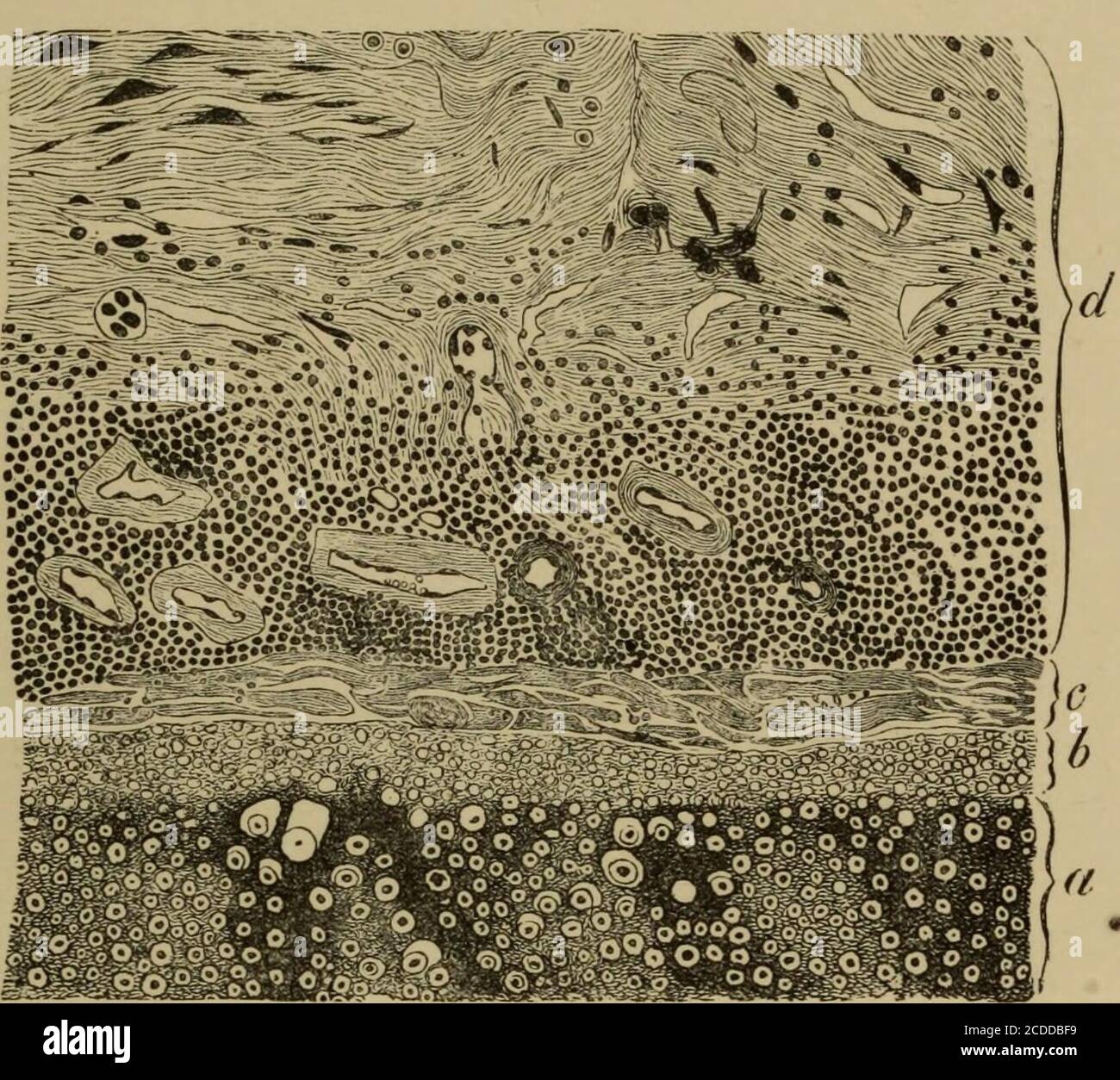 The elements of pathological histology with special reference to practical  methods . , etc.), or hythe direct extension of inflammation from  neighbouring parts (brain,dura mater, cranial bones, orbit, nasal cavity,  and