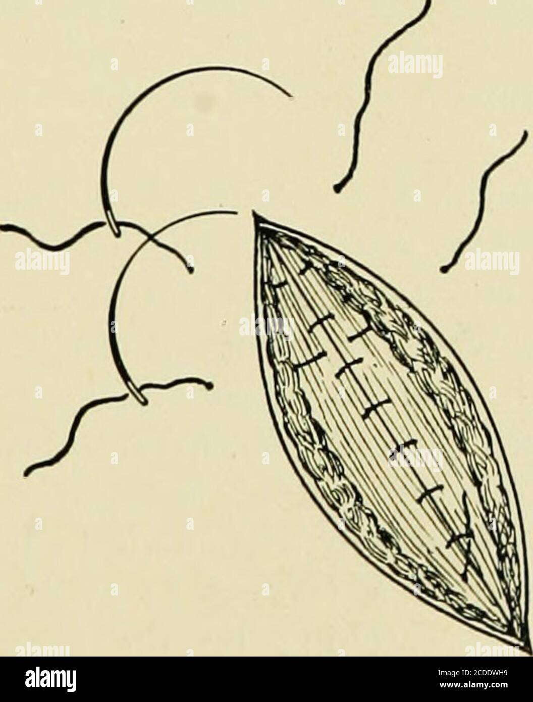 Surgical knots hires stock photography and images Alamy