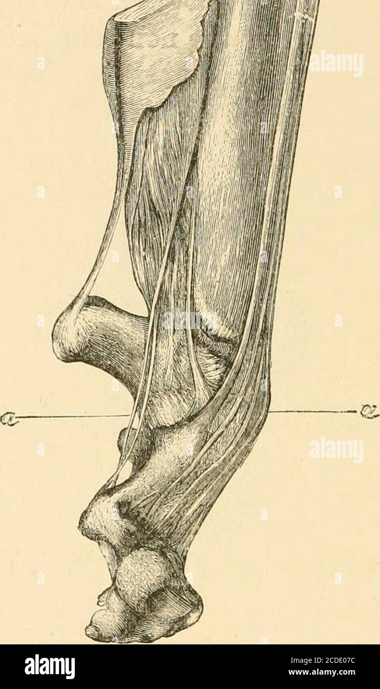 The Surgical Treatment Of The Common Deformities Of Children Fig 66 Acquired Spastic Equinus Club Foot Adams Ties May Arise From A Number Of Different Causes Maf Be Sp The Surgical Treatment Of The Common Deformities Of Children Fig 66 Acquired Spastic Equinus Club Foot Adams Ties May Arise From A Number Of Different Causes Maf Be Sp