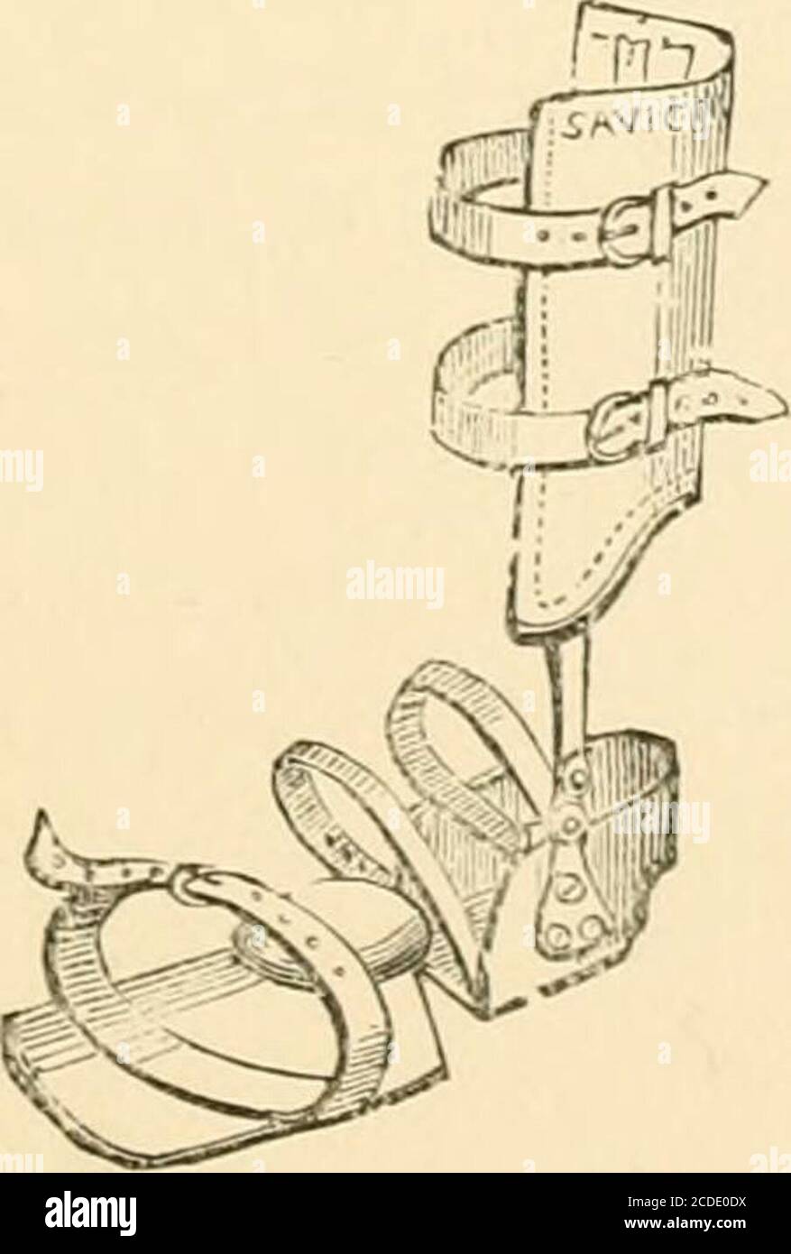 The Surgical Treatment Of The Common Deformities Of Children Fig 58 Simple Leg Instrument Running Up The Outside Of The Leg With An Anklehinge And A Firm Attachment To The Sole