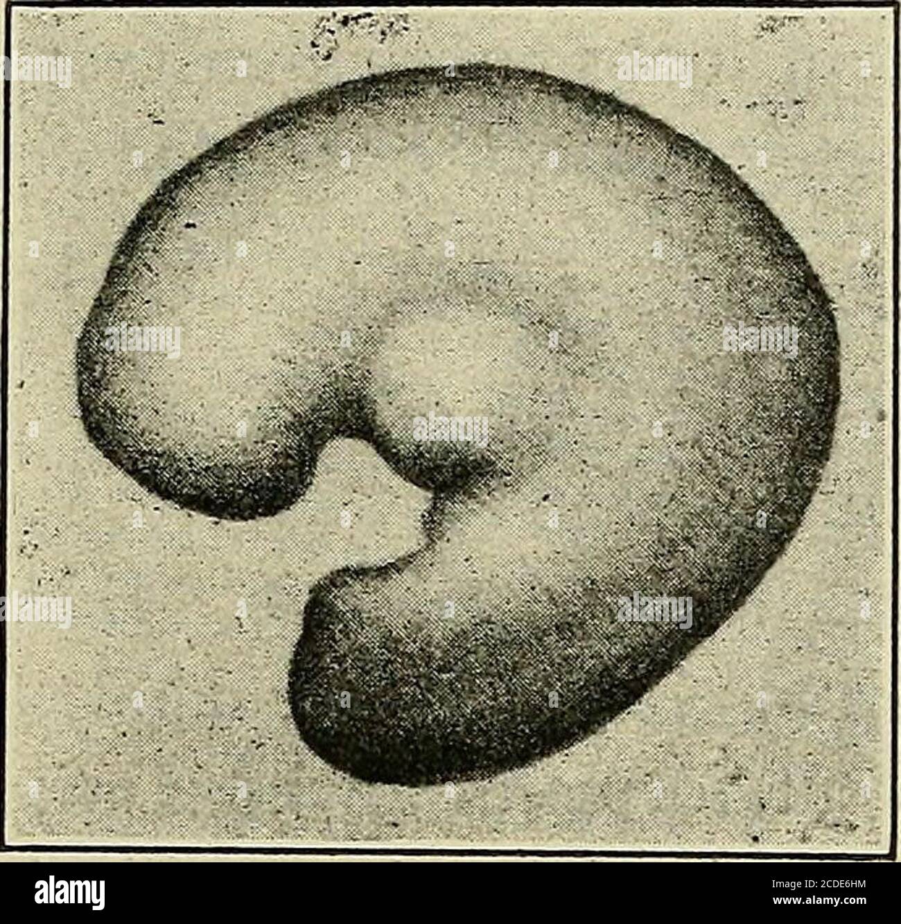 . A study of the causes underlying the origin of human monsters : third ...