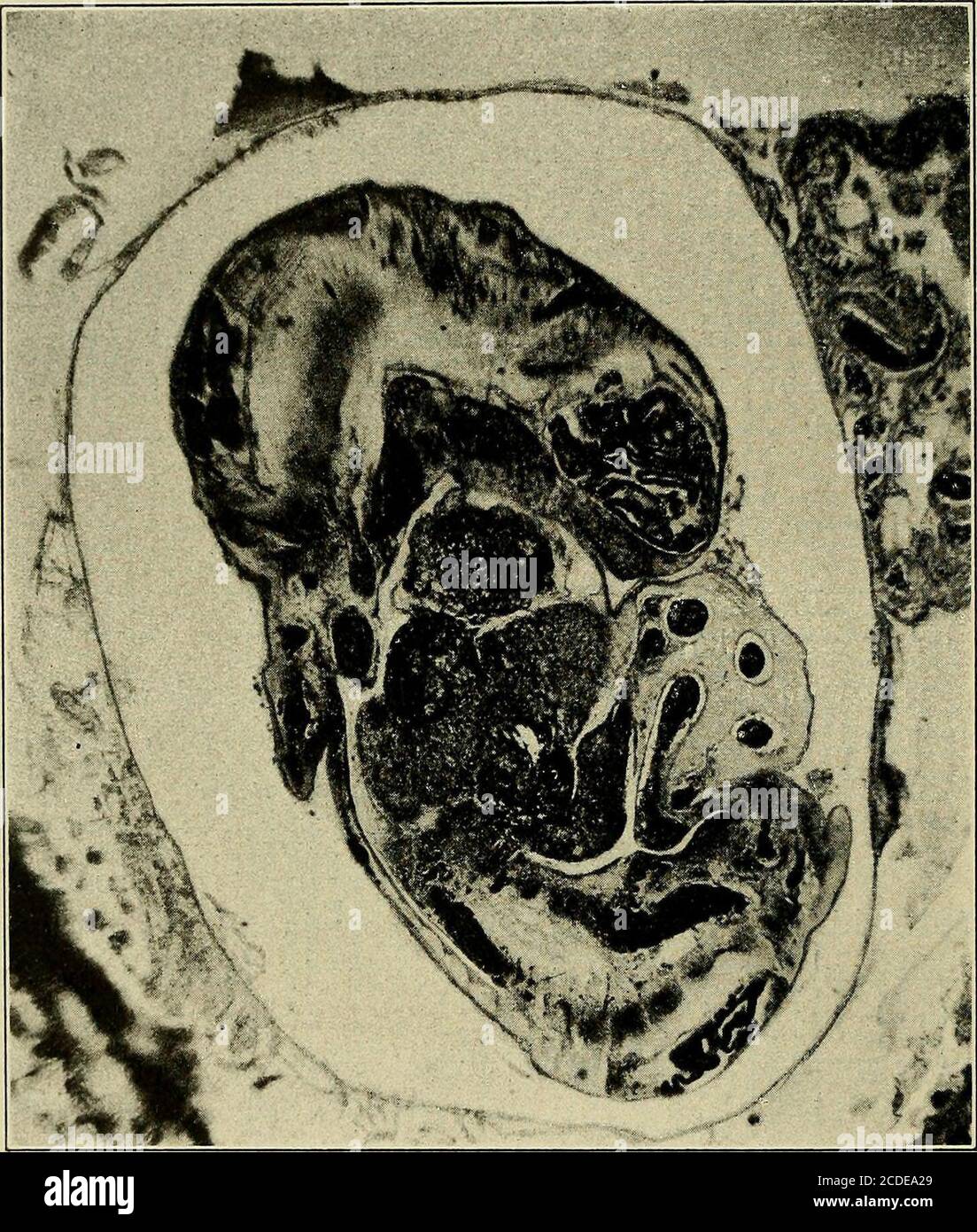 . A study of the causes underlying the origin of human monsters : third ...