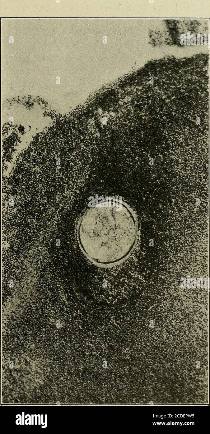 Human brain and capsules hires stock photography and images Alamy