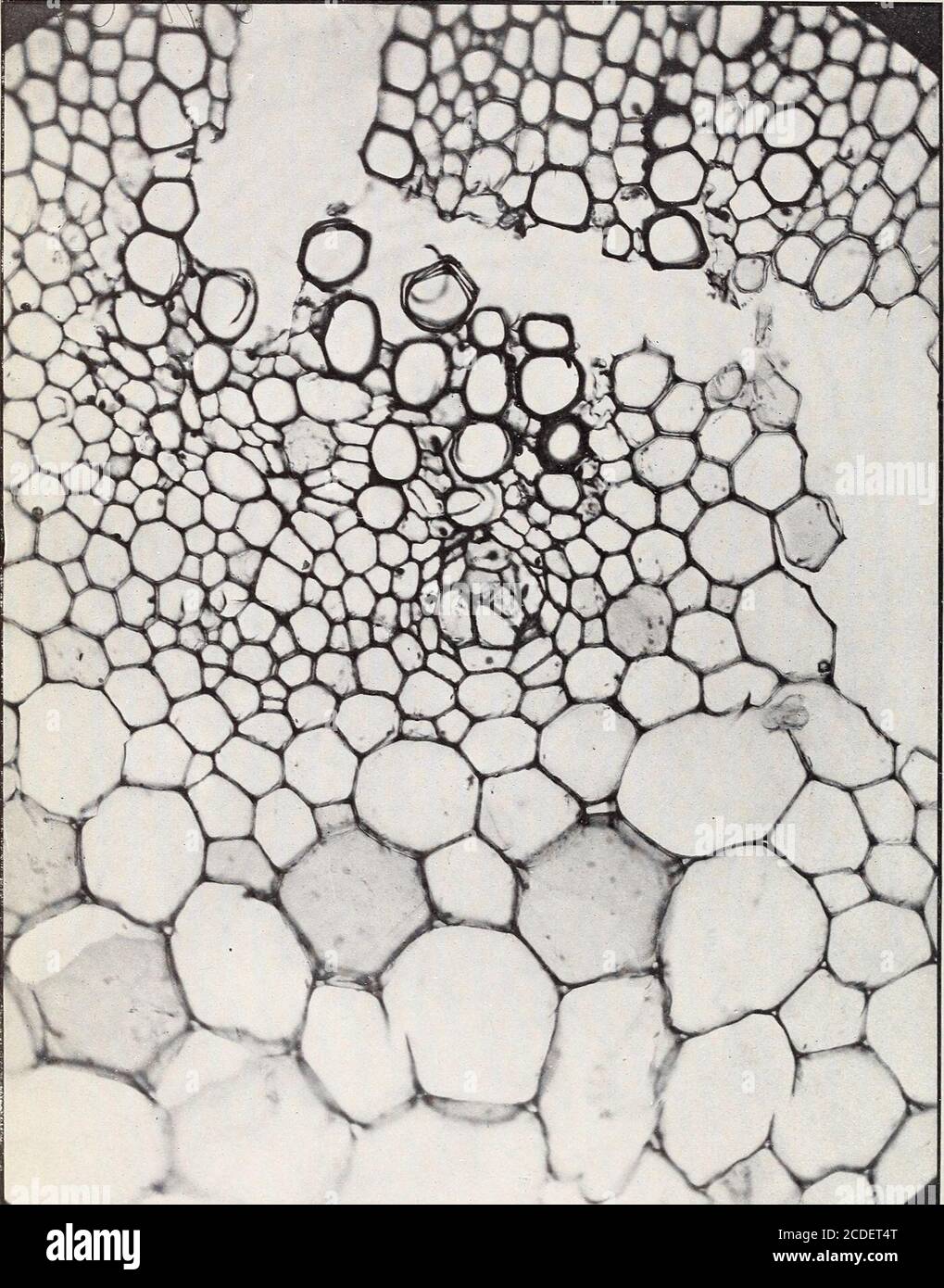 . The structure and development of crown gall a plant cancer . Daisy