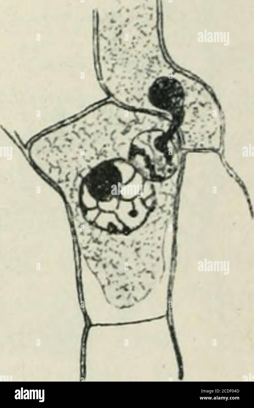 . Allgemeine Pflanzenkaryologie . Fig. 333. Phragmidium violaceum. Zutritt eines „somatischen Kernes zu einer 9Gamete. Vergr. 1350. (Nach Blackman.) Potenüllae canadensis und Puccinia Podophylli^), nach E. W. Oliate(1908) bei P. transformans, nach Mad. Moreau (1914 c) bei P. Malva-cearum, P. Biixi und Uromyces Ficariae (s. a. Maire 1911, S. 116). Endlich ist anscheinend auch der dritte Typus verwirklicht, d. h. Ver-schmelzung des Kerns einer 9 Zelle mit einem vegetativen Kern. Black-man (1904, Fig. 333) beschrieb ihn als erster für Phragmidium violaceum,Blackman und Fräser (1906) bestätigten i Stock Photo