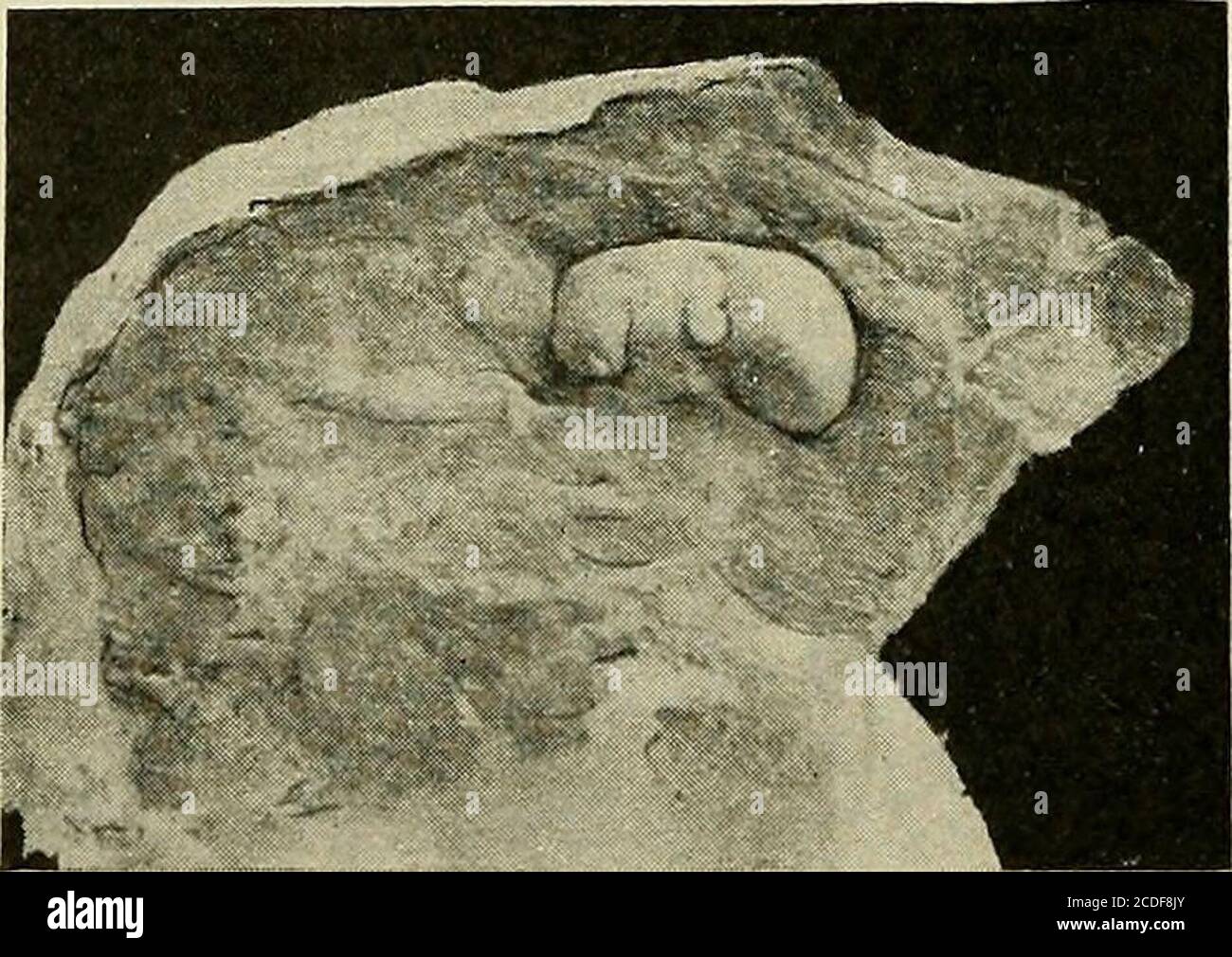. A study of the causes underlying the origin of human monsters : third ...