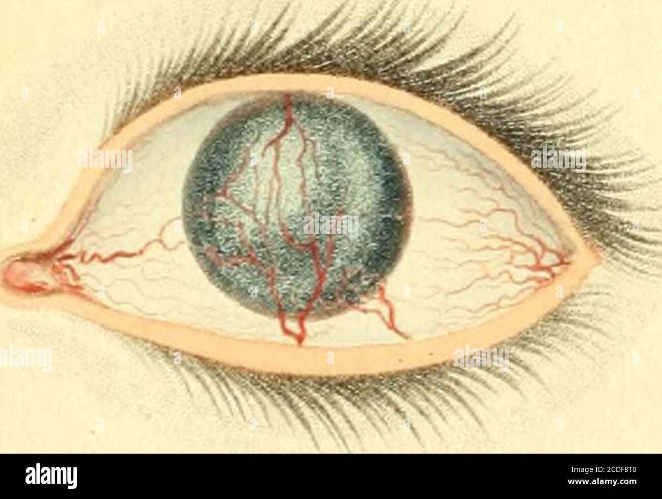 Human Eye Disoder . A synopsis of the diseases of the eye, and their treatment : to which ...