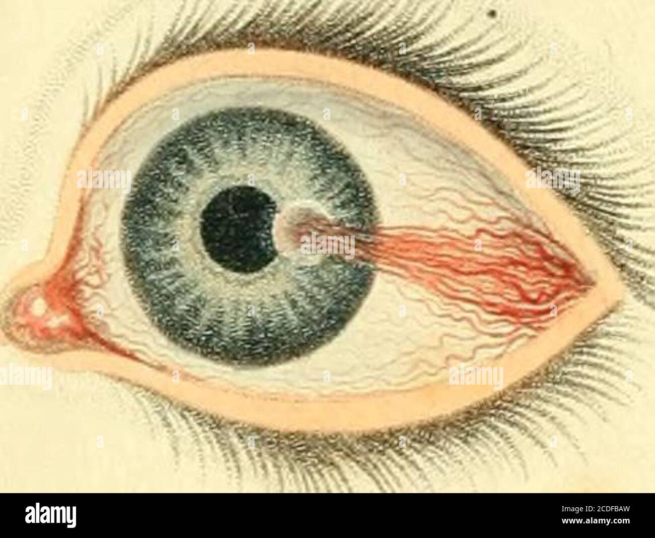 Human Eye Disoder . A synopsis of the diseases of the eye, and their treatment : to which ...