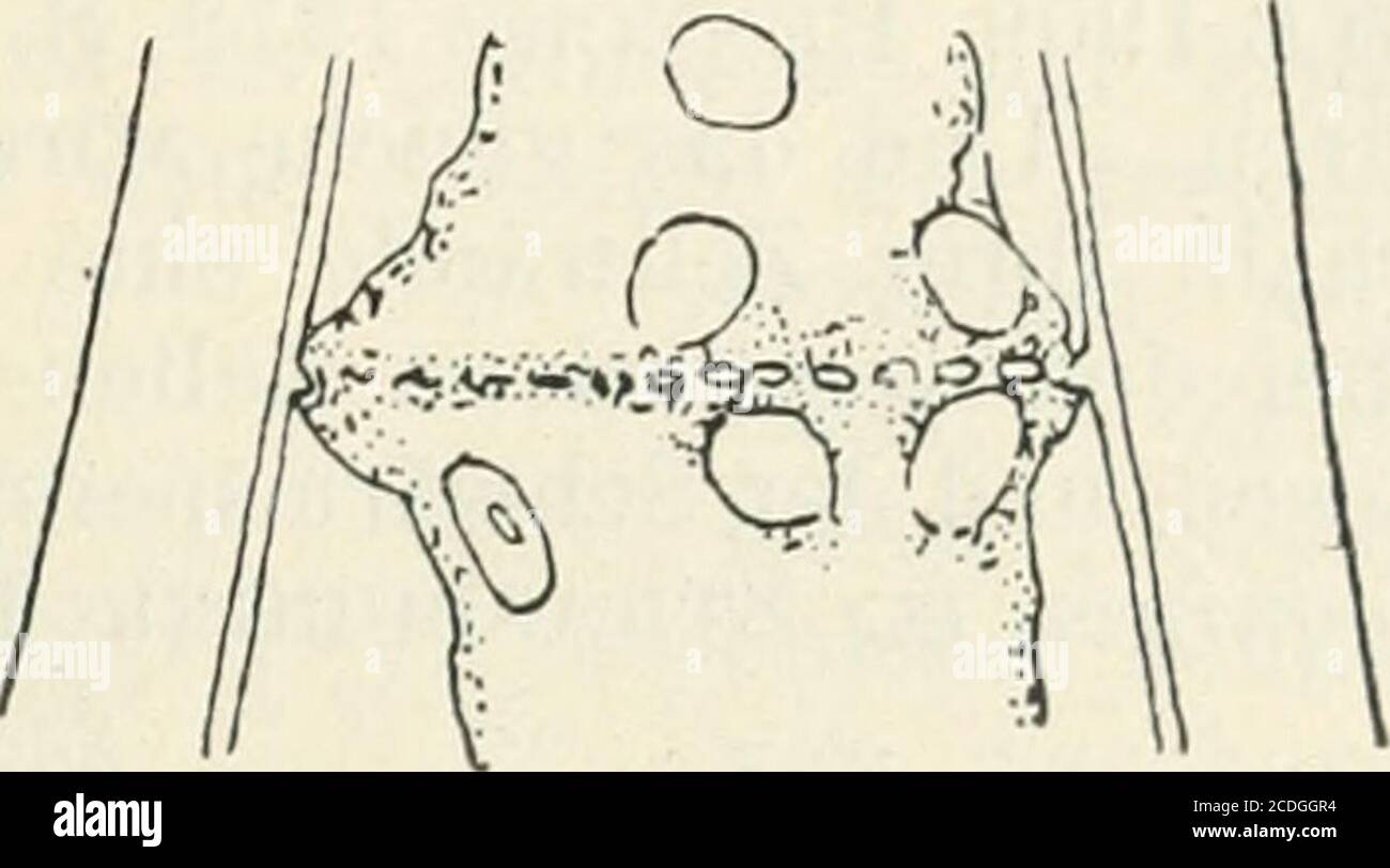 . Allgemeine Pflanzenkaryologie . Fig. 103 Helodea densa. Partie eines Blattzahns, in der nach Plasmolyse die Teilungeingetreten ist. a Die Querwand weist nur ein einziges kleines Loch auf, das von derPlasmabrücke durchsetzt ist, die die beiden Teilprotoplasten verbindet, b desgleichen,die Querwand besitzt jedoch, einer „Siebplatte gleichend, eine größere Anzahl kleinerLöcher (nachträglich mit 50% Glycerin plasmolysiert). (Nach Haberlanut.) Stock Photo