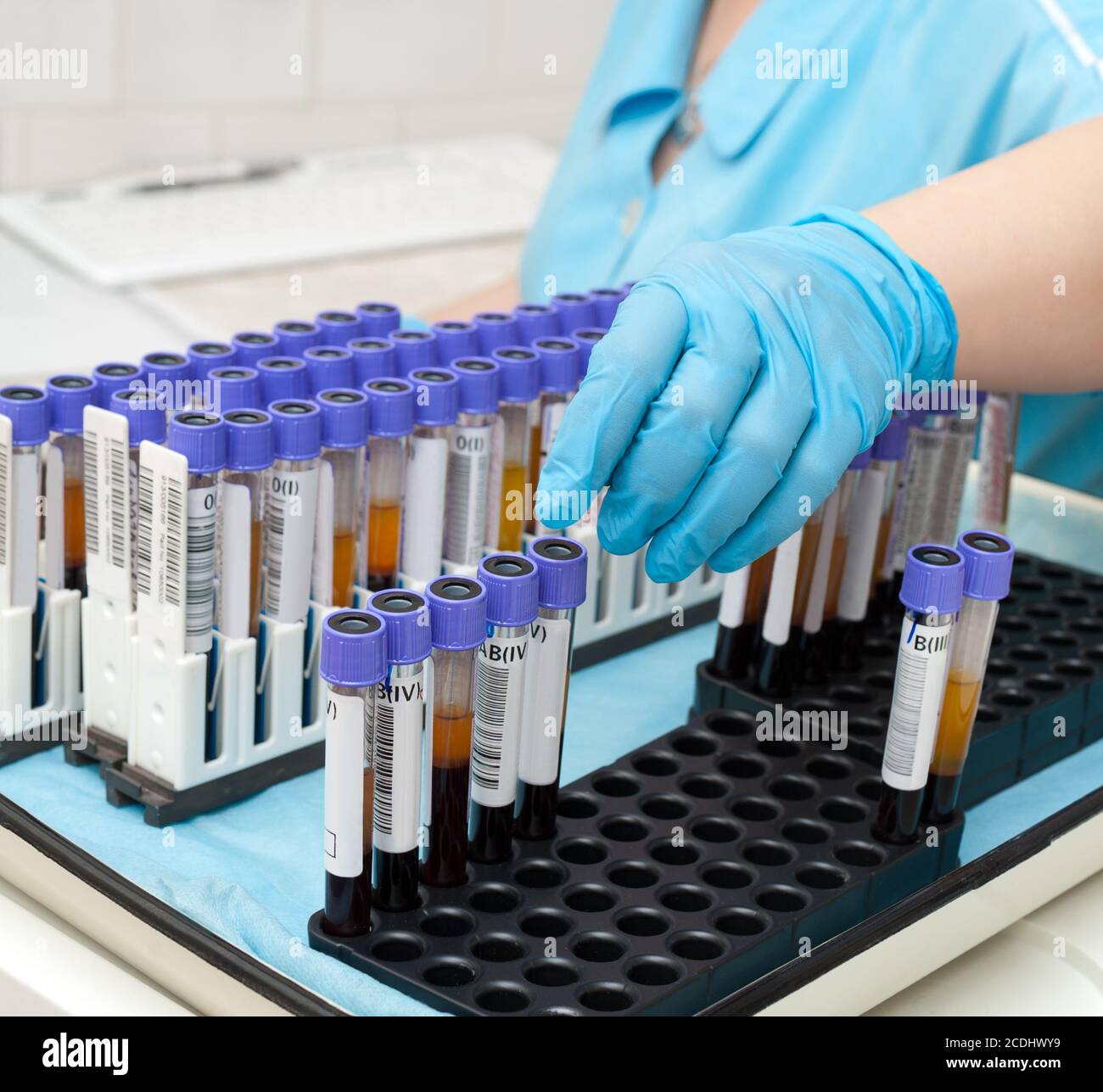 test tubes with blood Stock Photo