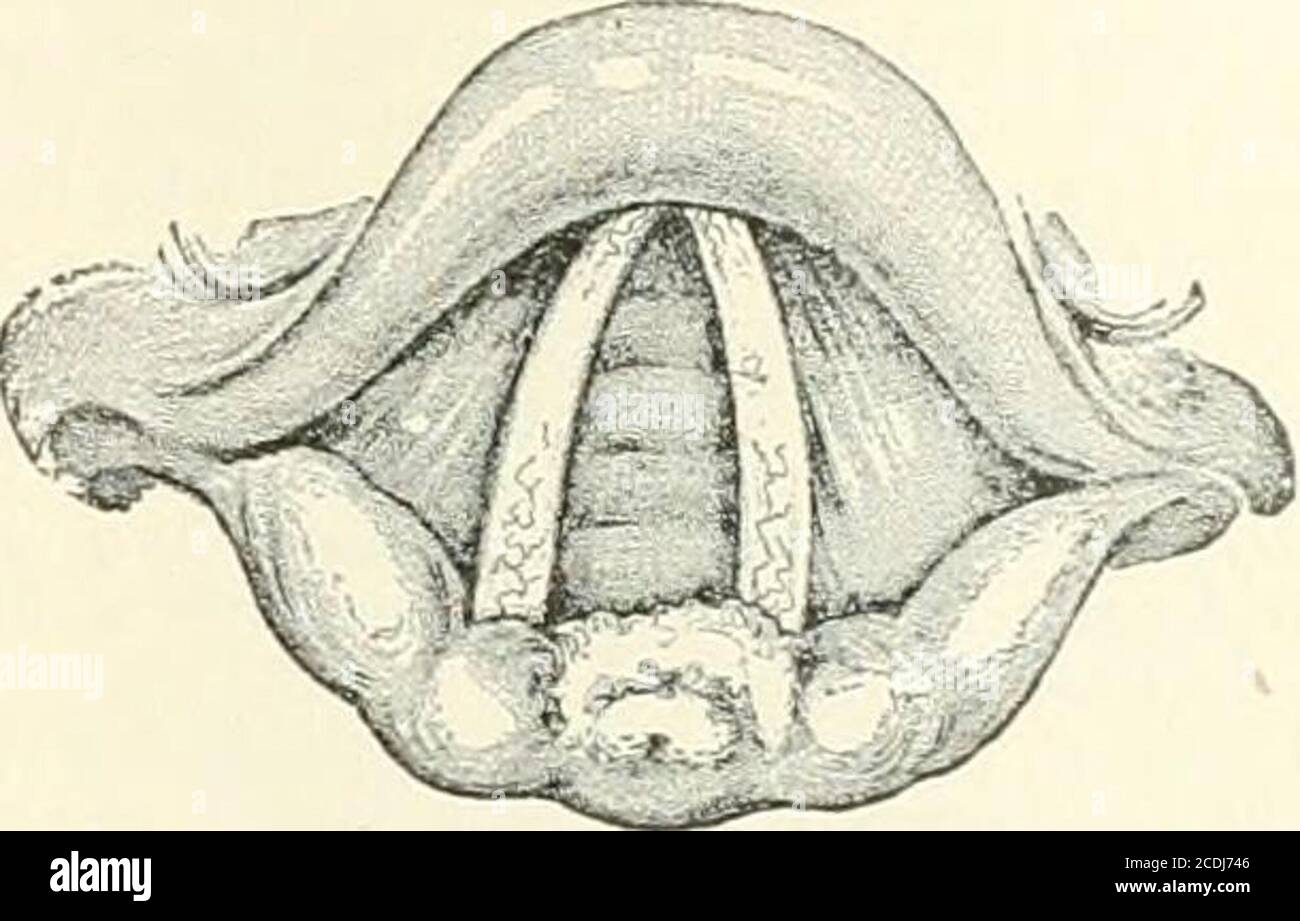 . A Reference handbook of the medical sciences embracing the entire range of scientific and practical medicine and allied science . , in addition to the swelling and conges-tion, there may be shallow erosions or excoriations, formorning cough, accompanied by an expectoration of mu-cus, streaked or tinged with slight traces of blood, is com-mon in chronic laryngitis. In the atrophic form, added to a wasting of the tissues, there is usually a drying oftlie mucus on the surface, particularly in the commis-sures. This inspissated mucus will sometimes have to beremoved with the cotton-covered appli Stock Photo