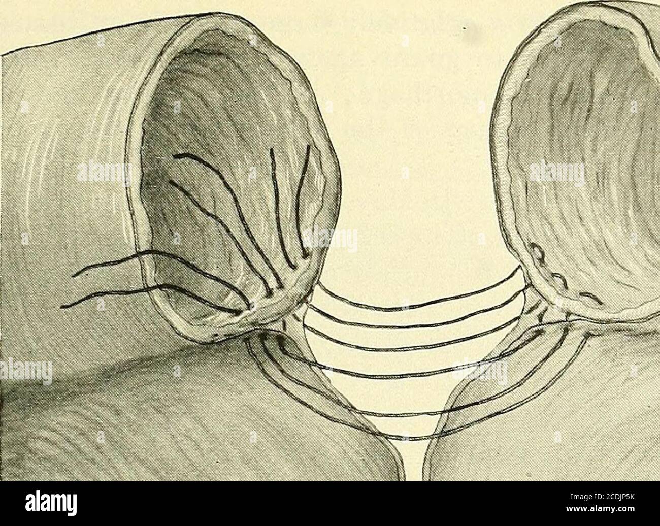 Kelly clamp hires stock photography and images Alamy