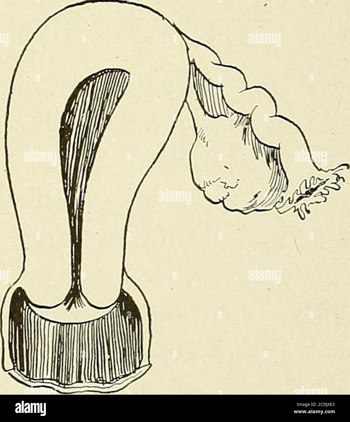 . Gynecology : . Fig. 174.—Uterus Biforis. Fig. 175.—Uterus Unicornis. The uterine cavity is single, the cervical canal The adnexa of one side are wanting. Normalis double. Normal in the ant-eater. in birds. (7) Uterus biforis. The canal of the body is normal, but a septum dividesthe cervix completely so that there is a double orifice (Fig. 174). (8) Uterus unicornis. In this form there is complete absence of one-half ofthe uterus (Fig. 175). The foregoing are the essential malformations, but they may assume variousforms as a result of unequal development in the two sides. If both halves of ad Stock Photo
