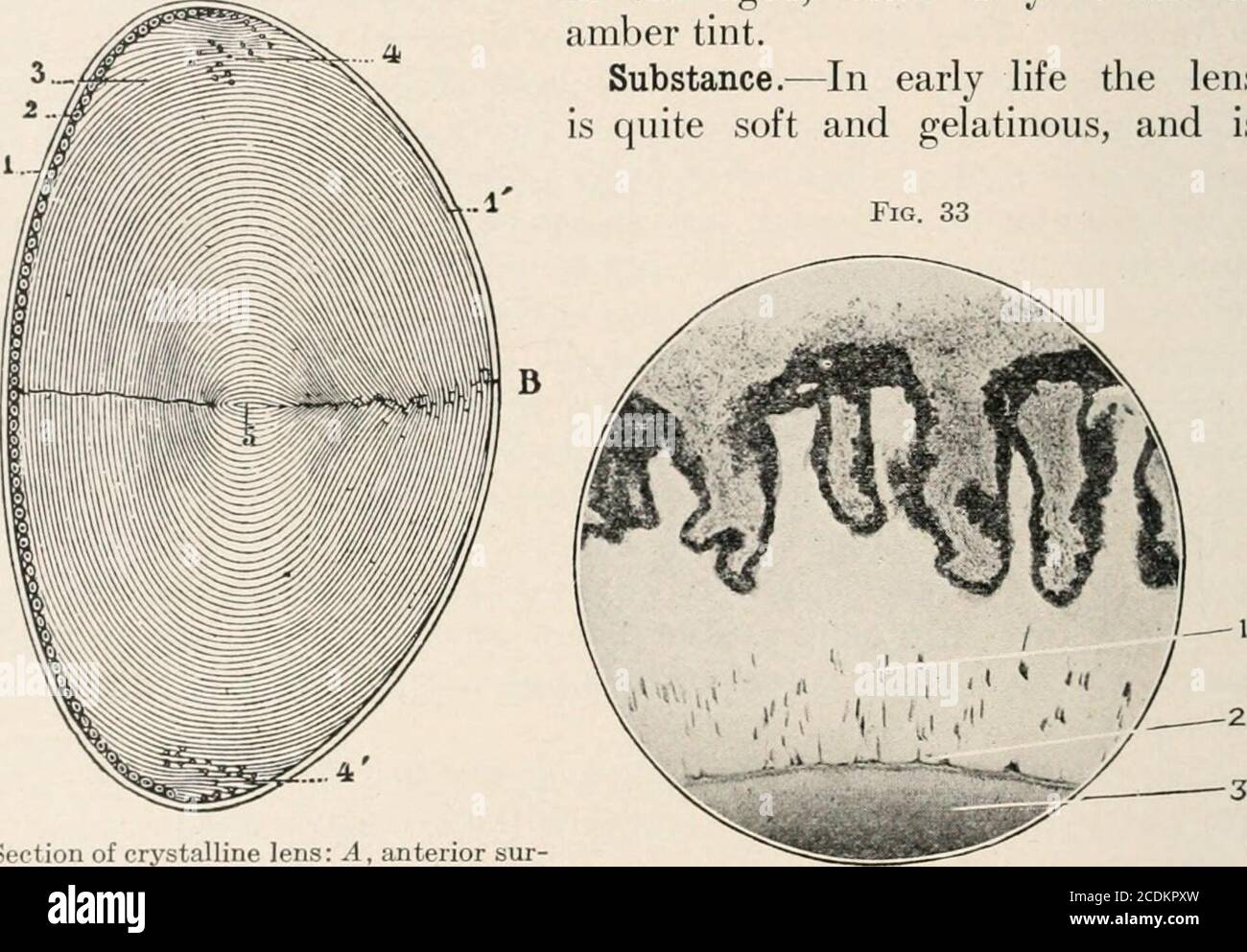 . A treatise on diseases of the eye . s 2.8 3.3 Six months 3.5 4.0 Nine ...