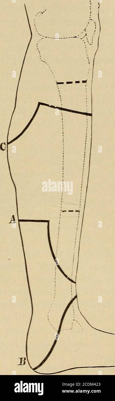. Minor and operative surgery, including bandaging . Fig 427 ...