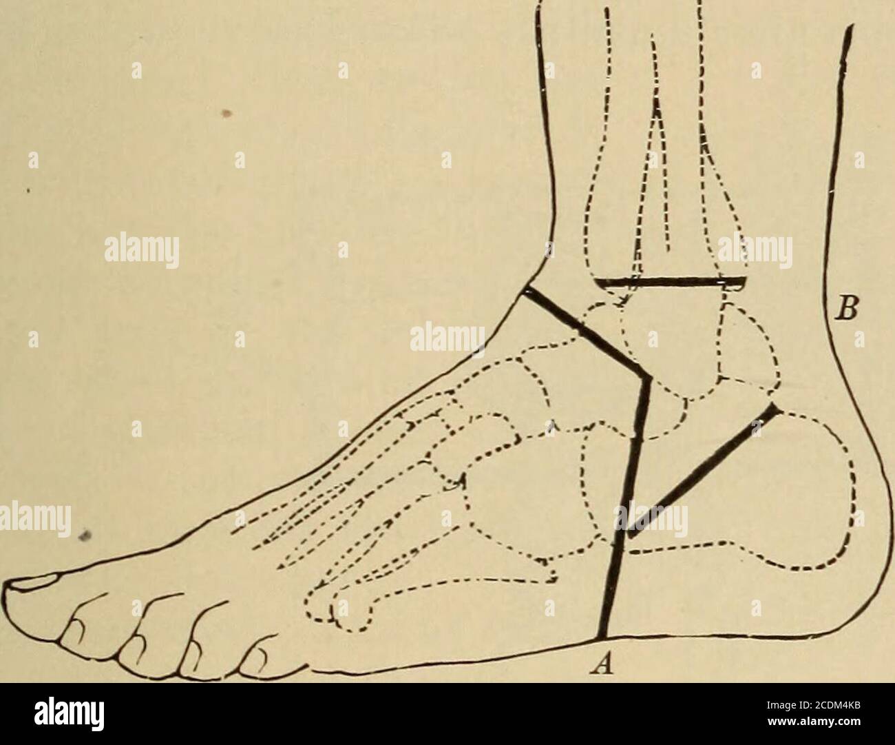 . Minor and operative surgery, including bandaging . Symes amputation