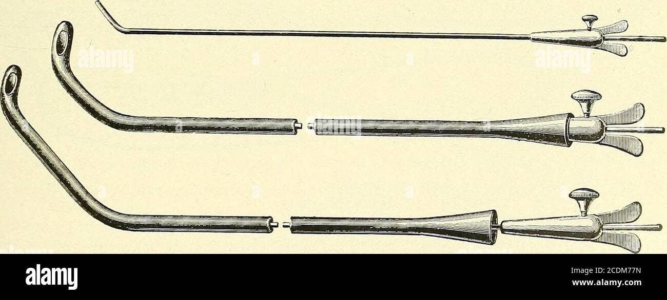 . Surgery, its principles and practice . Fig. 224.—Gum Prostatic or