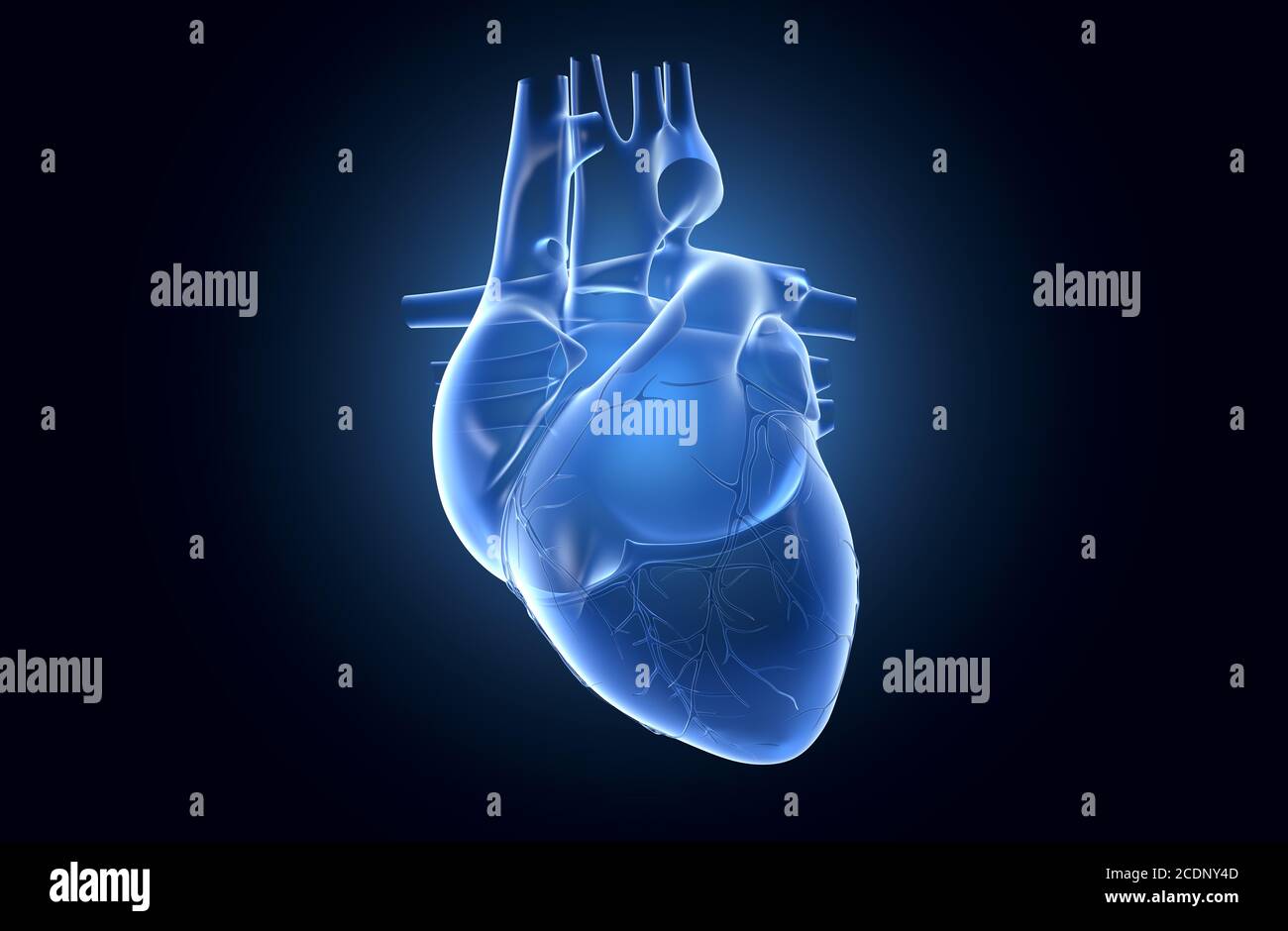 Human heart x ray hires stock photography and images Alamy