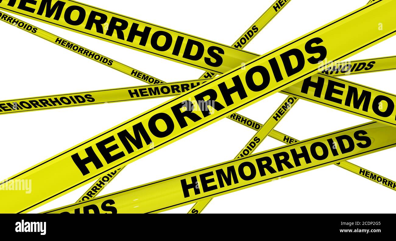 Hemorrhoids. Yellow warning tapes with black words HEMORRHOIDS. Isolated. 3D Illustration Stock Photo