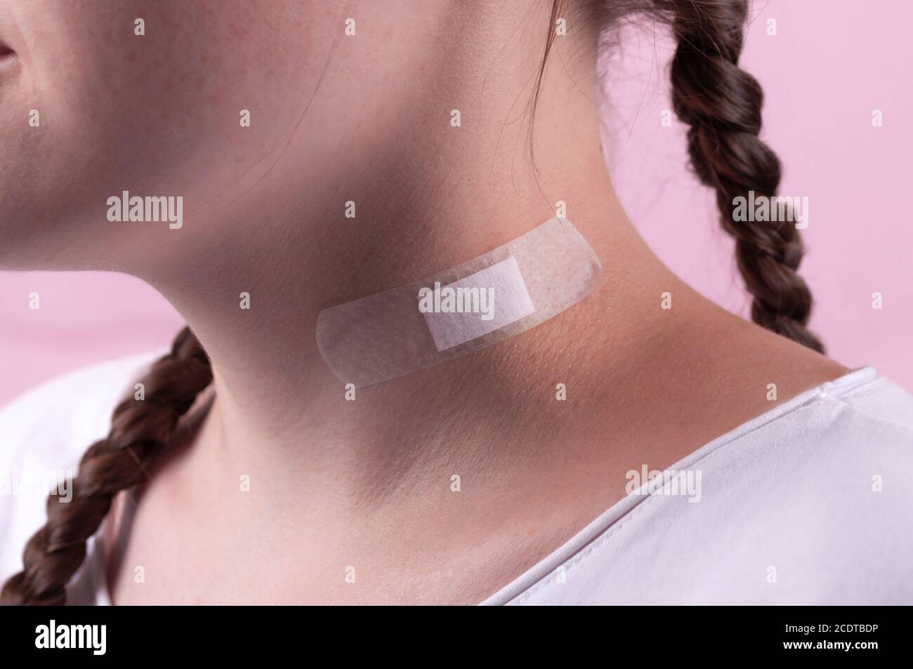 Injury on the neck sealed with a plaster. Providing medical care. The wound was sealed with a plaster. Medical plaster. The girl has a neck injury. Th Stock Photo