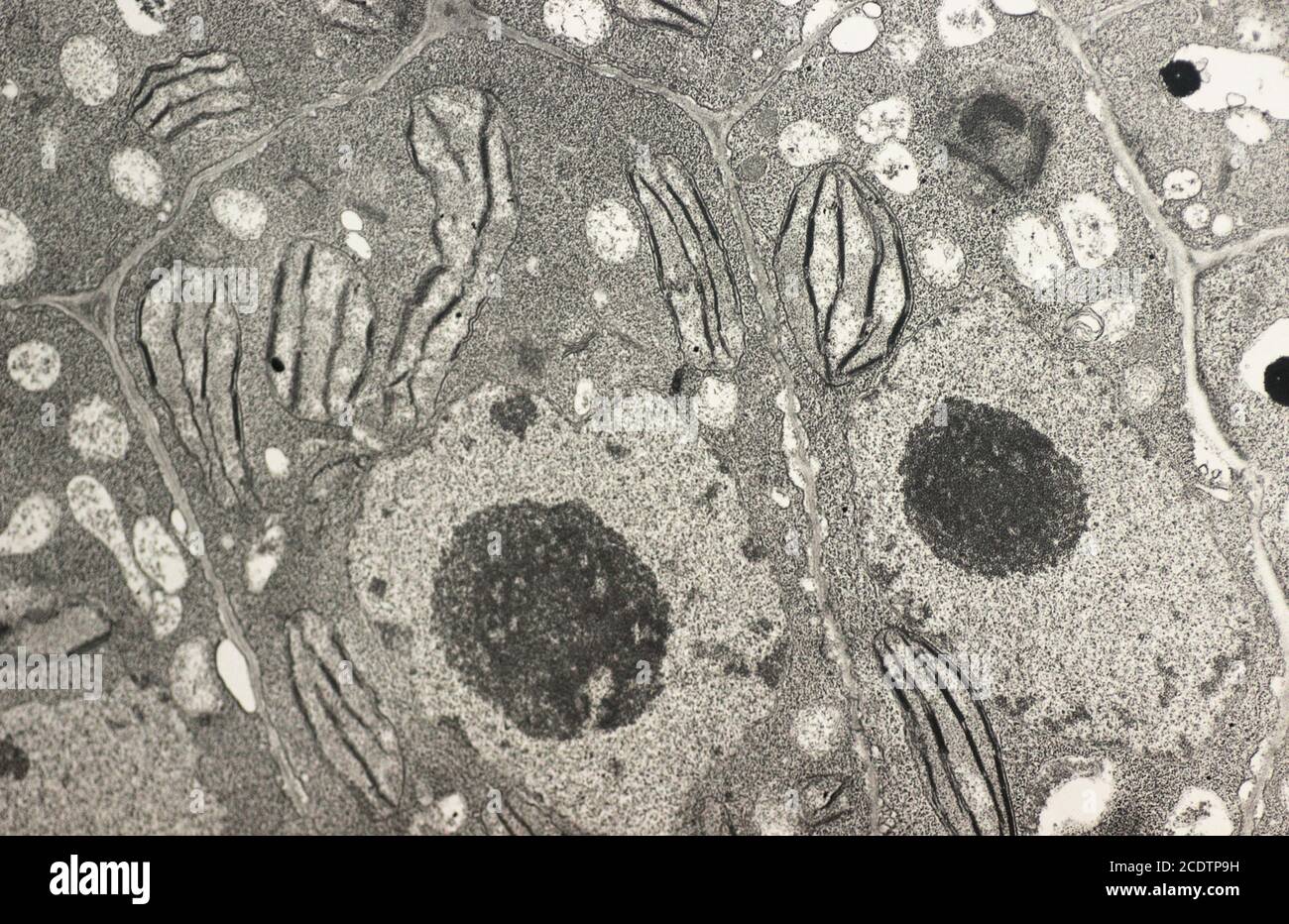 Vegetal cell showing nucleus, cell wall, nucleoli, chloroplast and starch. A ultrathin section of tobacco leaf mesophyll cells showing chloroplast str Stock Photo